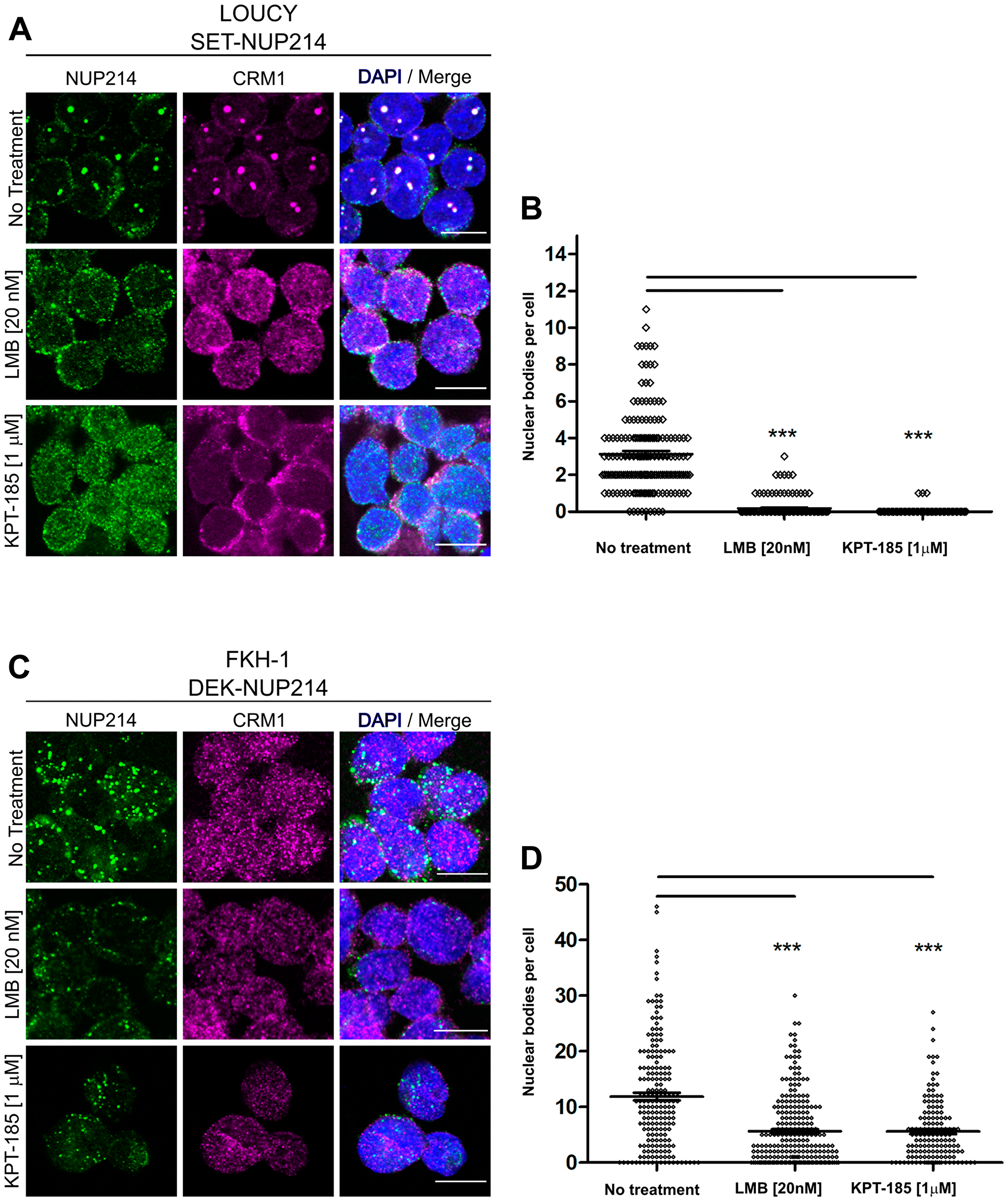 NUP214 fusion proteins are sensitive to inhibition of CRM1