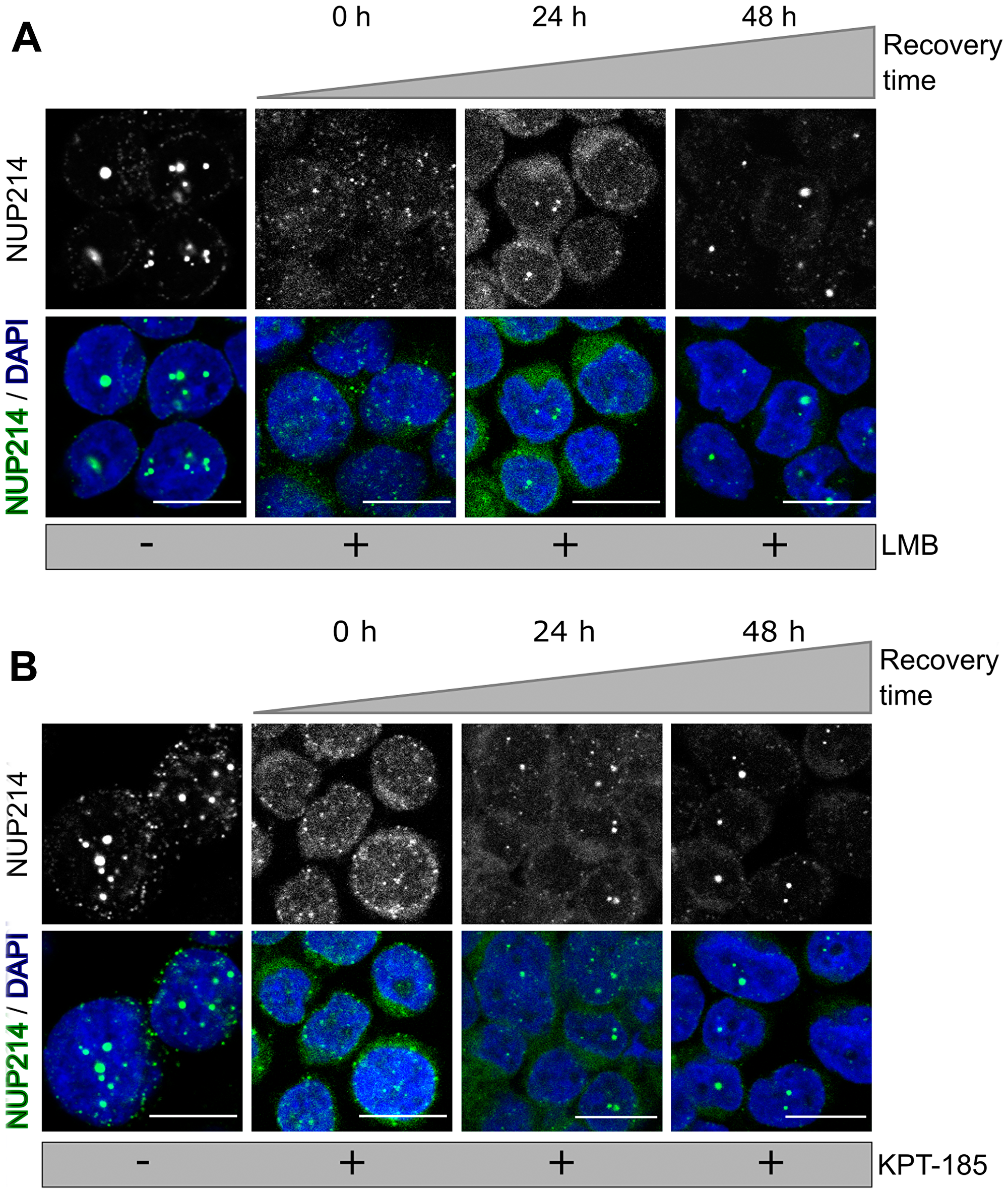 NUP214 nuclear foci reform after withdrawal of CRM1 inhibition
