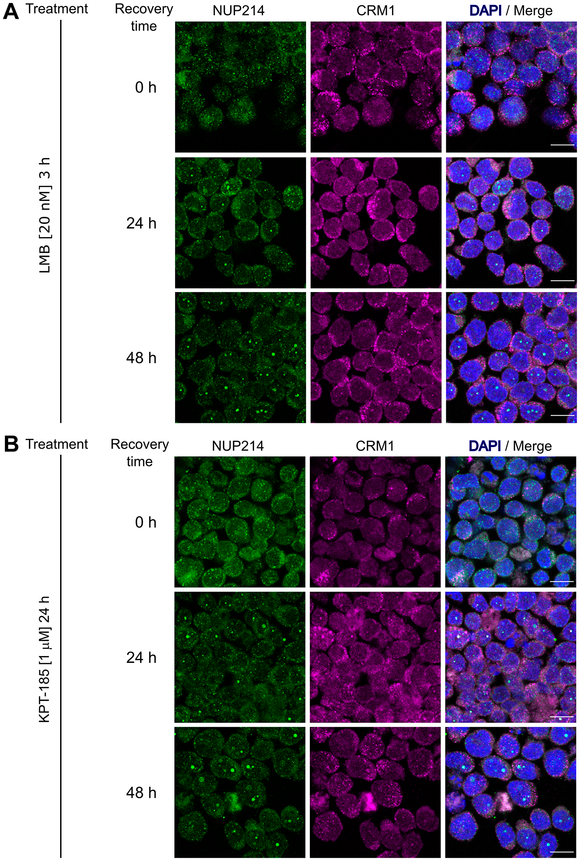 Formation of NUP214 nuclear after withdrawal of CRM1 inhibition is accompanied by CRM1 accumulation