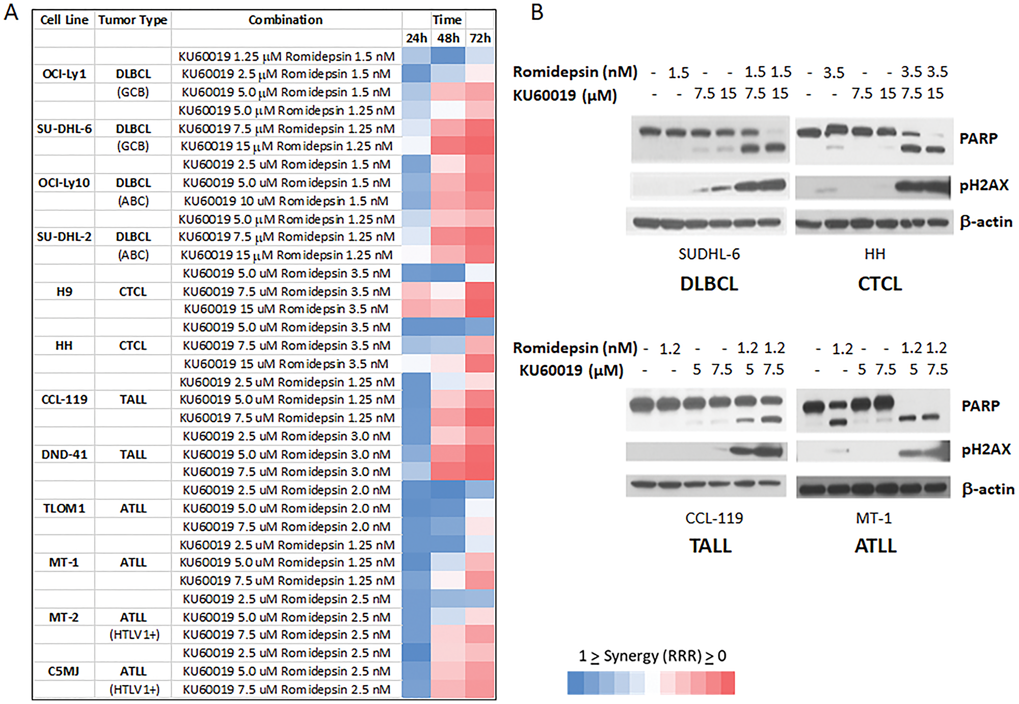 The ATM inhibitor KU60019 and Romidepsin are highly synergistic in in vitro models of DLBCL, CTCL, TALL, ATLL