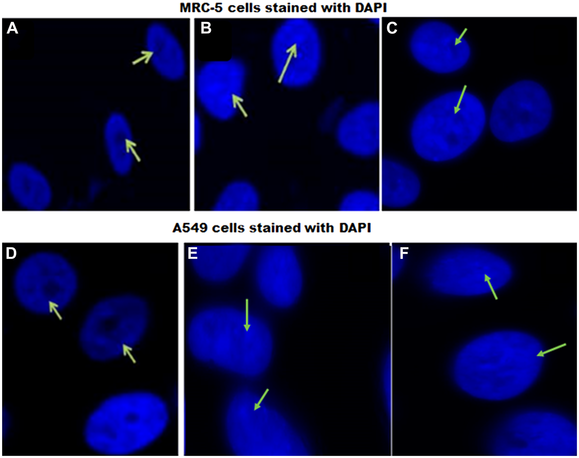 DAPI staining of MRC-5 and A549 cells in response to EFV