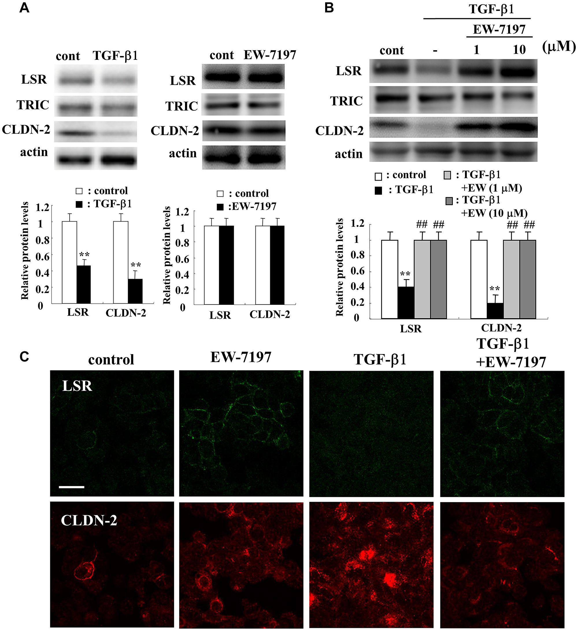 Effects of TGF-β1 and TGF-β receptor inhibitor EW7197 for LSR and CLDN-2 in A549 cells