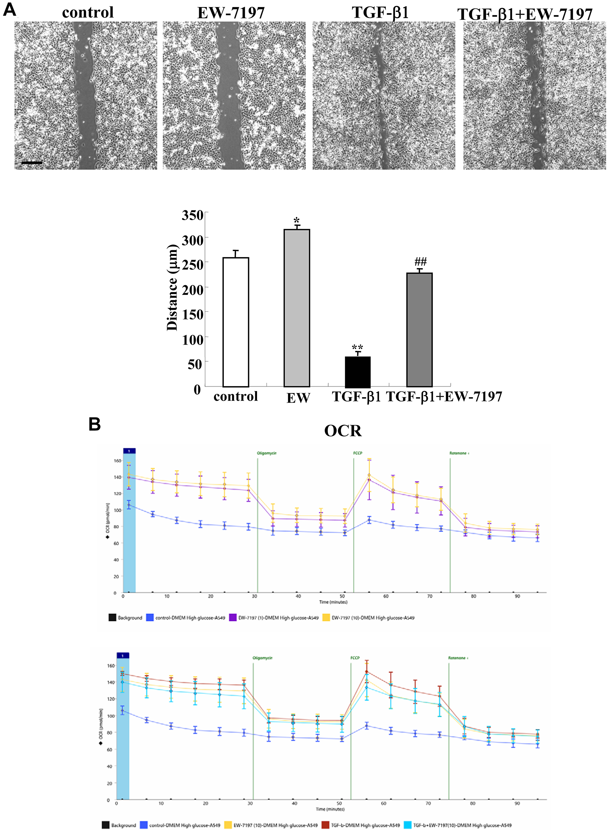 Effects of TGF-β1 and TGF-β receptor inhibitor EW7197 for cell migration and OCR in A549 cells