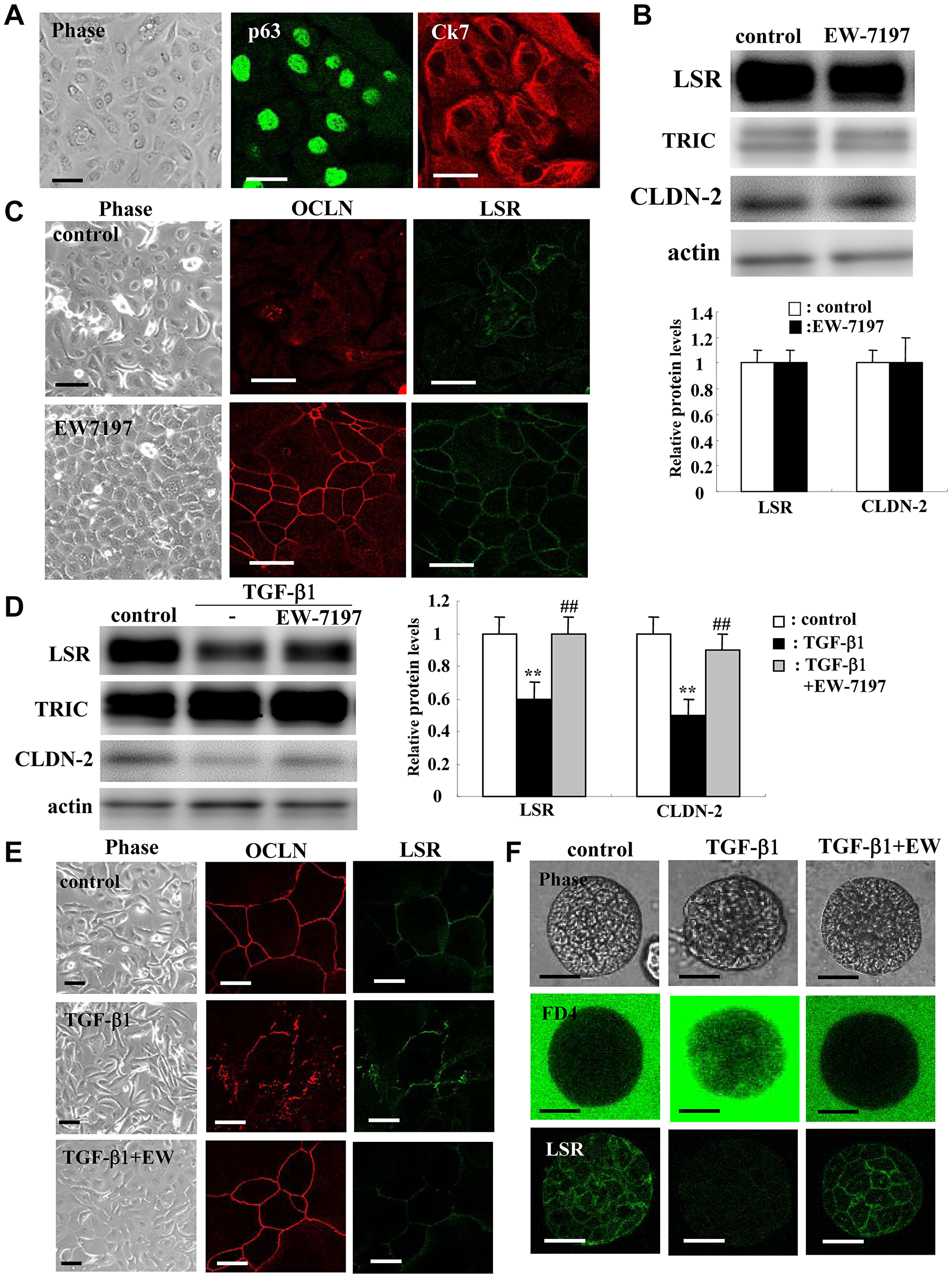 Effects of TGF-β receptor inhibitor EW7197 with and without TGF-β1 for LSR, TRIC, OCLN, and CLDN-2 in human lung epithelial cells (HLE) cells with and without 10% FBS