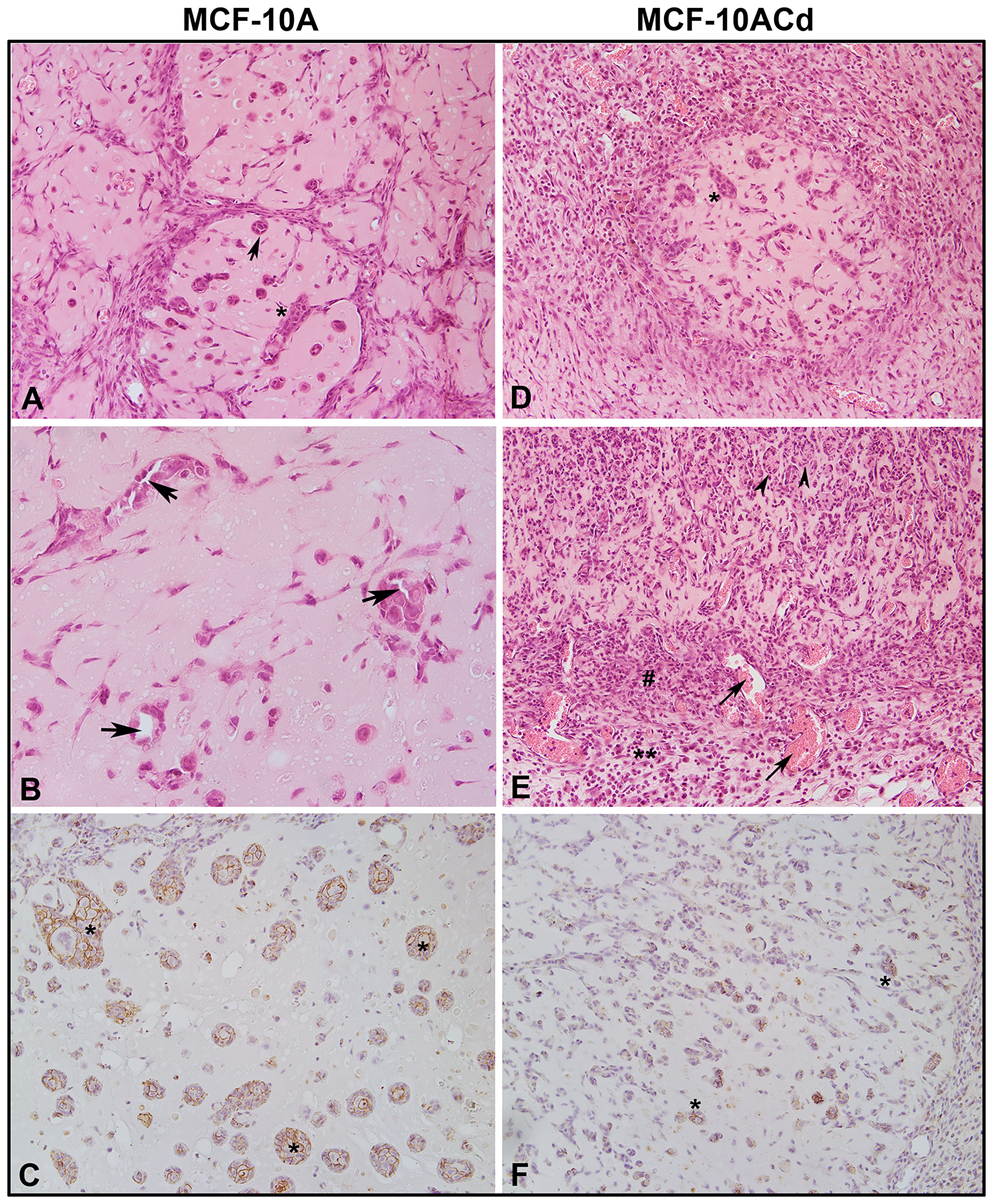 Histology and immunohistochemistry of nodules produced by MCF-10A and MCF-10ACd cells