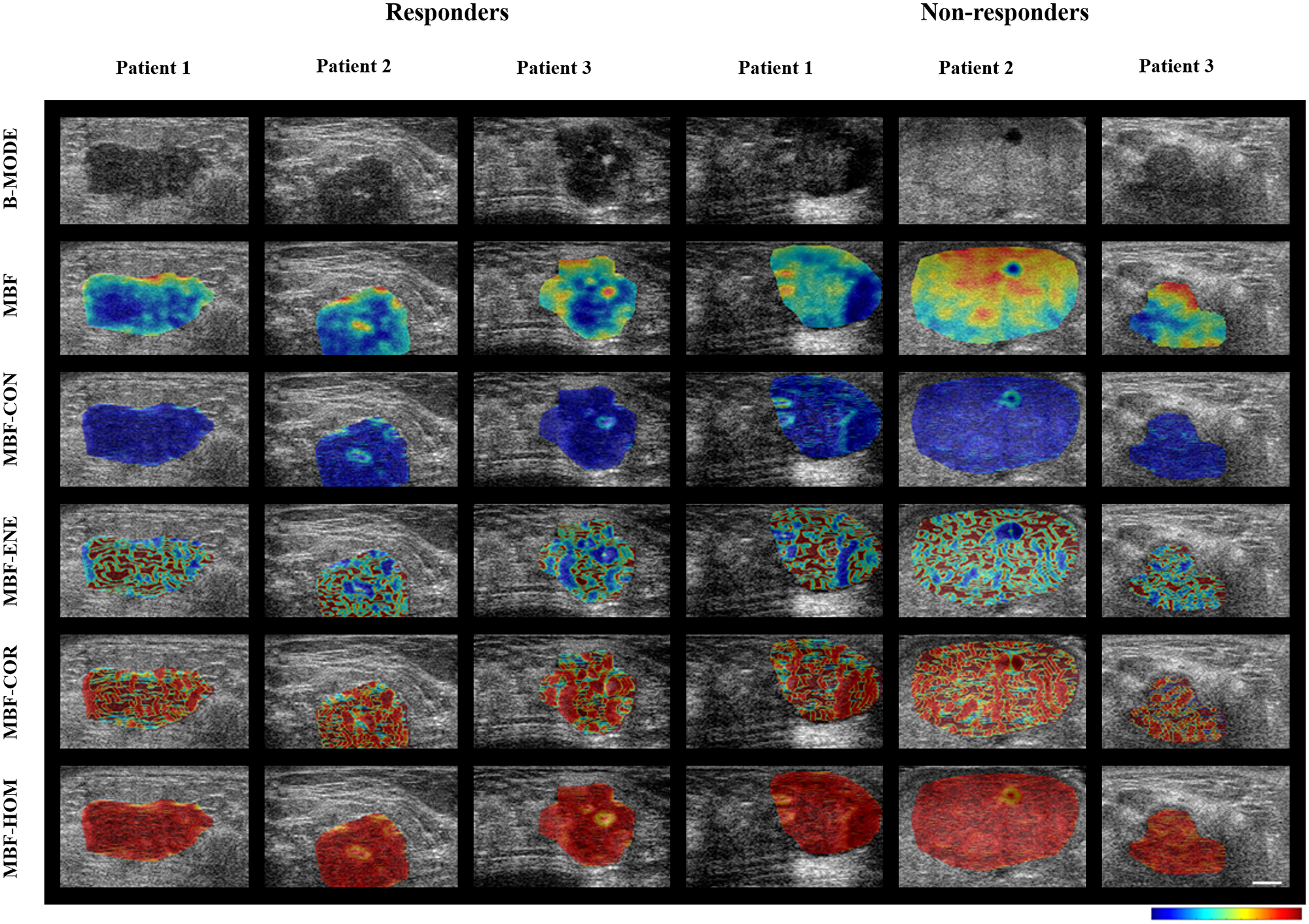 Parametric maps for the two response groups