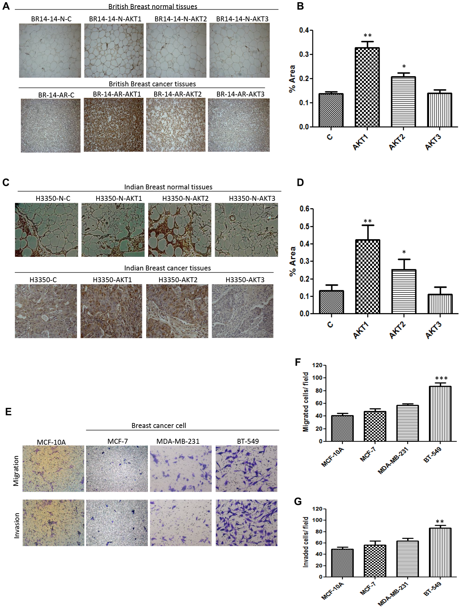 Correlation of AKT isoform expression with malignant breast cancer