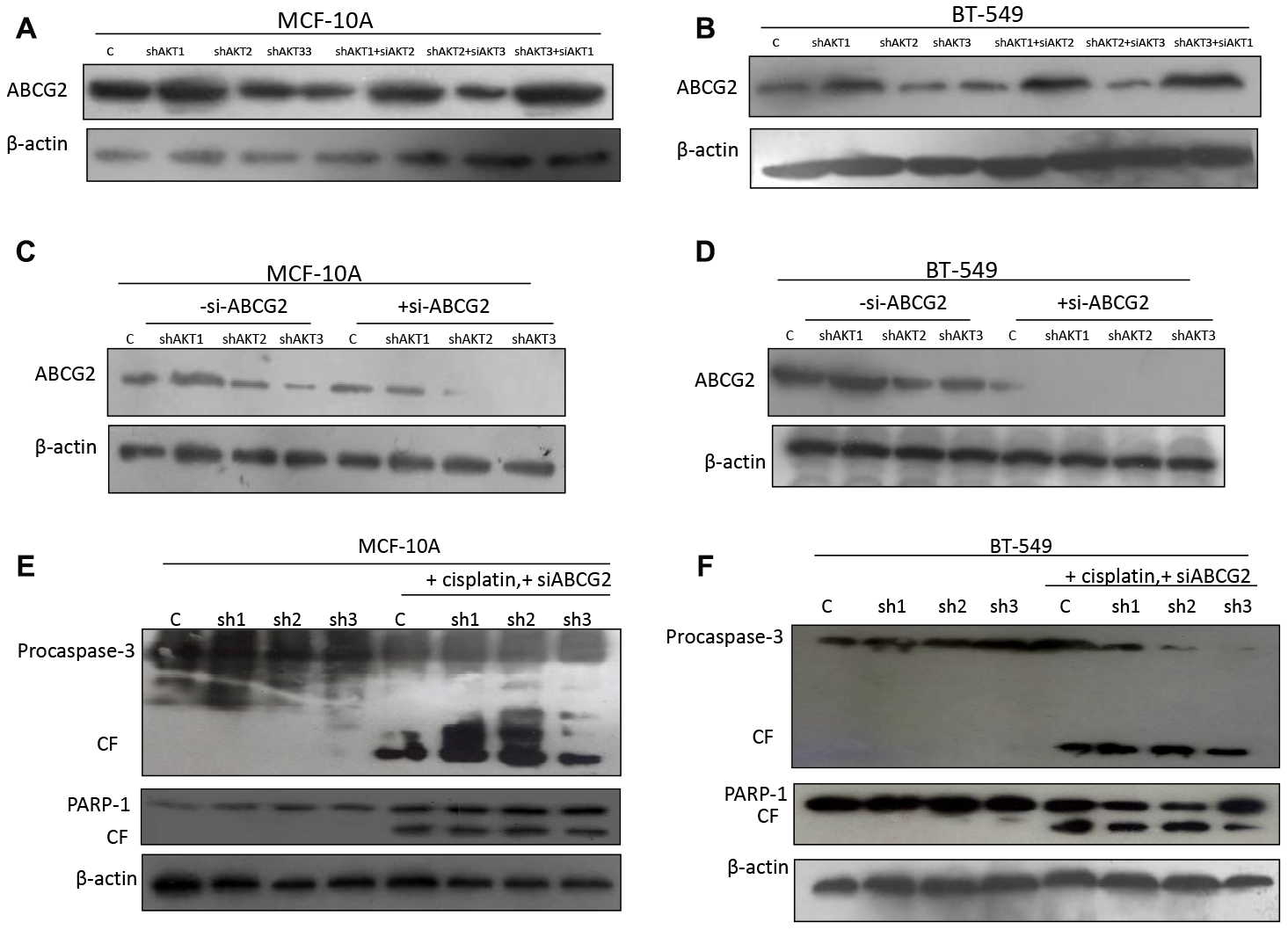 AKT1 effect on ABCG2 while abrogating cisplatin sensitivity
