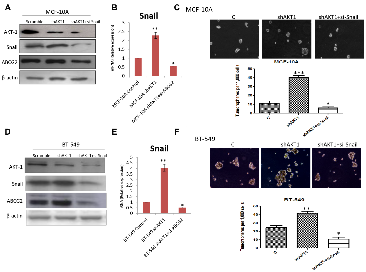 Knockdown of Snail in shAKT1 (A) MCF-10A and (D) BT-549 cells decreased the expression of ABCG2. qPCR analysis confirming the enhanced expression of Snail in (B) MCF-10A shAKT1 and (E) BT-549 shAKT1 cells. Knockdown of Snail in shAKT1 (C) MCF-10A and (F) BT-549 declined the number of sphere formation ability. Data are reported as mean ± SEM, with significance indicated by *p $!--ESC