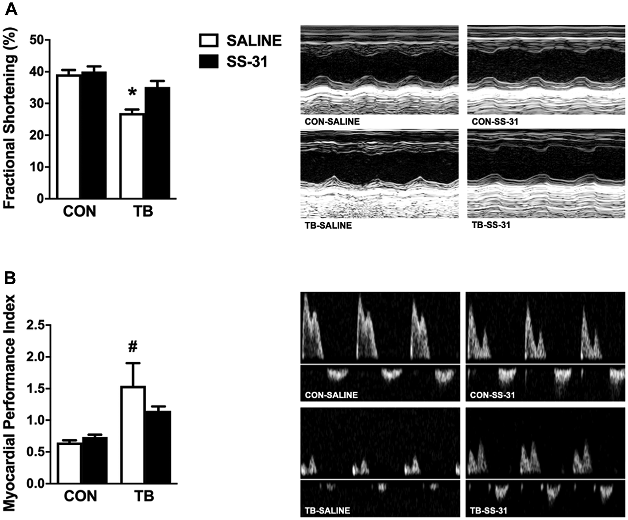 Cardiac function