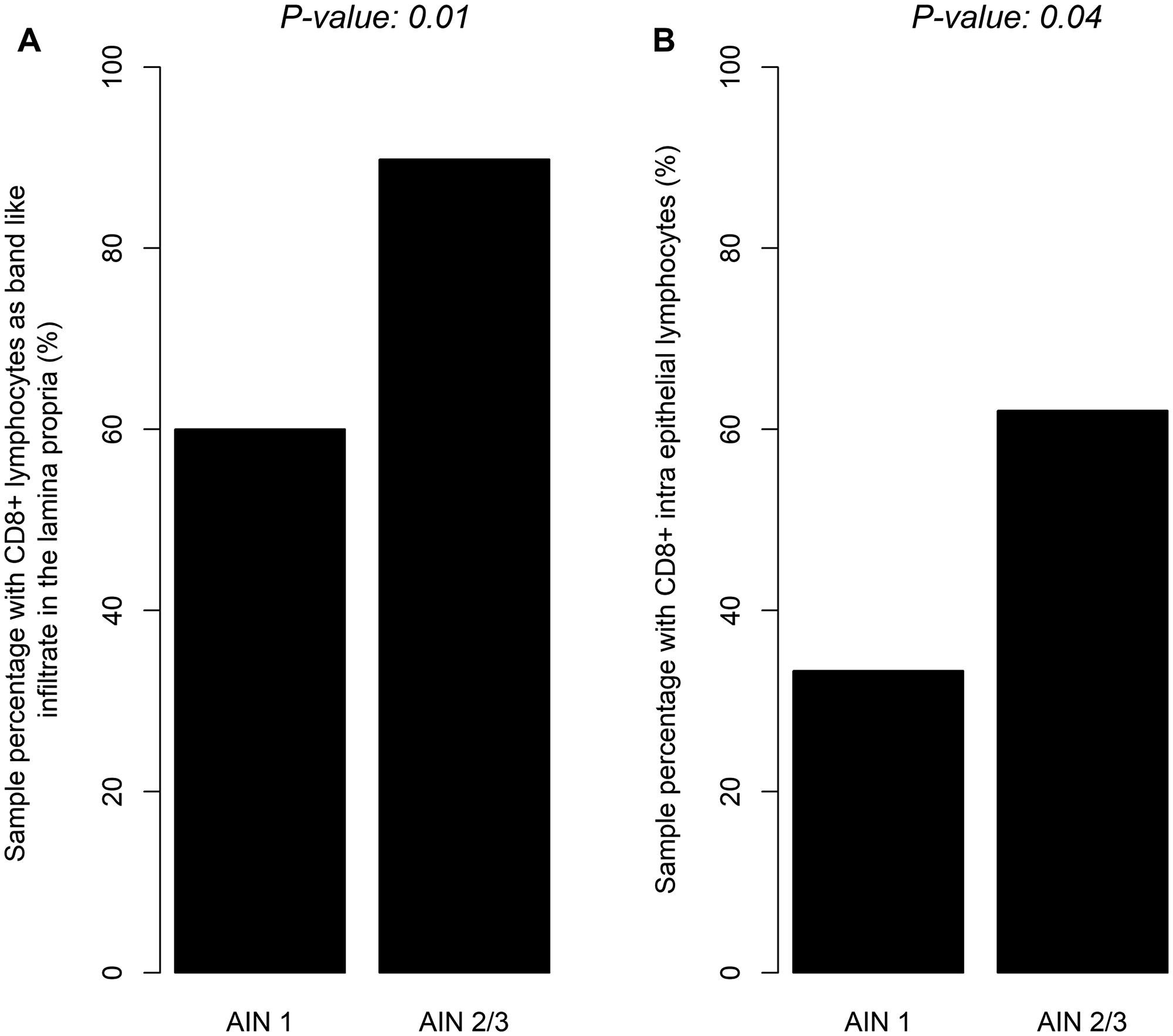 Distribution of CD8+ band like lymphocytic infiltrate in lamina proria (A) or CD8+ intra epithelial lymphocytes (B) according to severity of dysplasia (LSIL/HSIL).