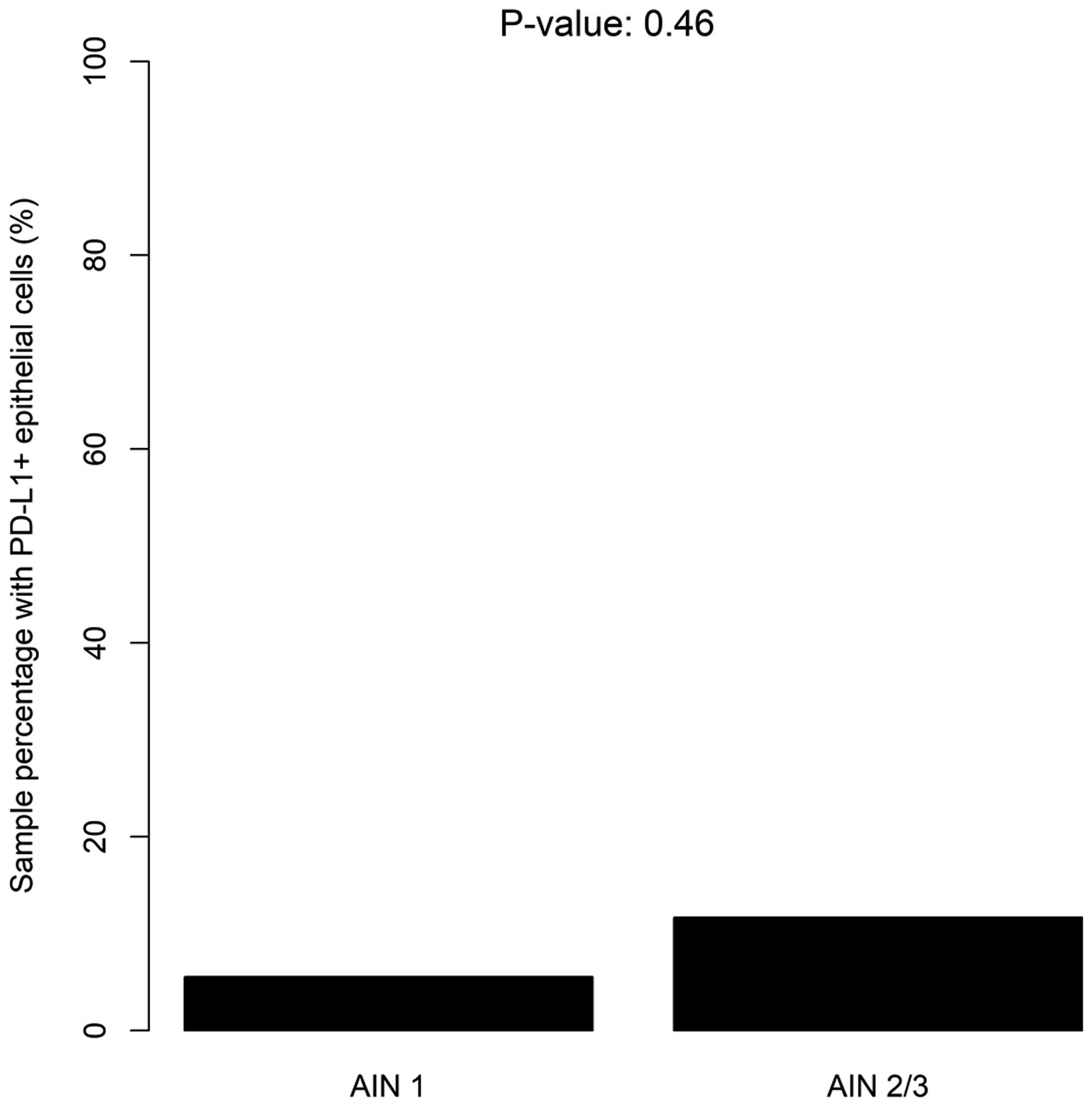 Distribution of PD-L1+ epithelial cells according to the severity of dysplasia (LSIL/HSIL)