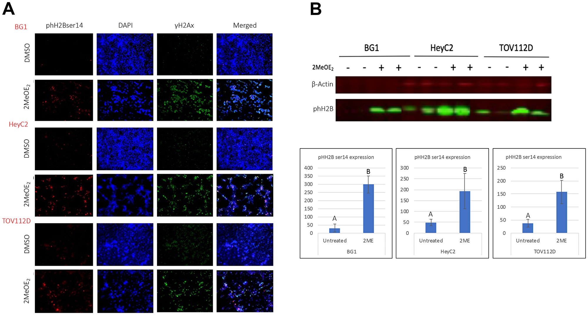 2MeOE2 induces phosphorylation on ser 14 of histone H2B in human ovarian cancer cells