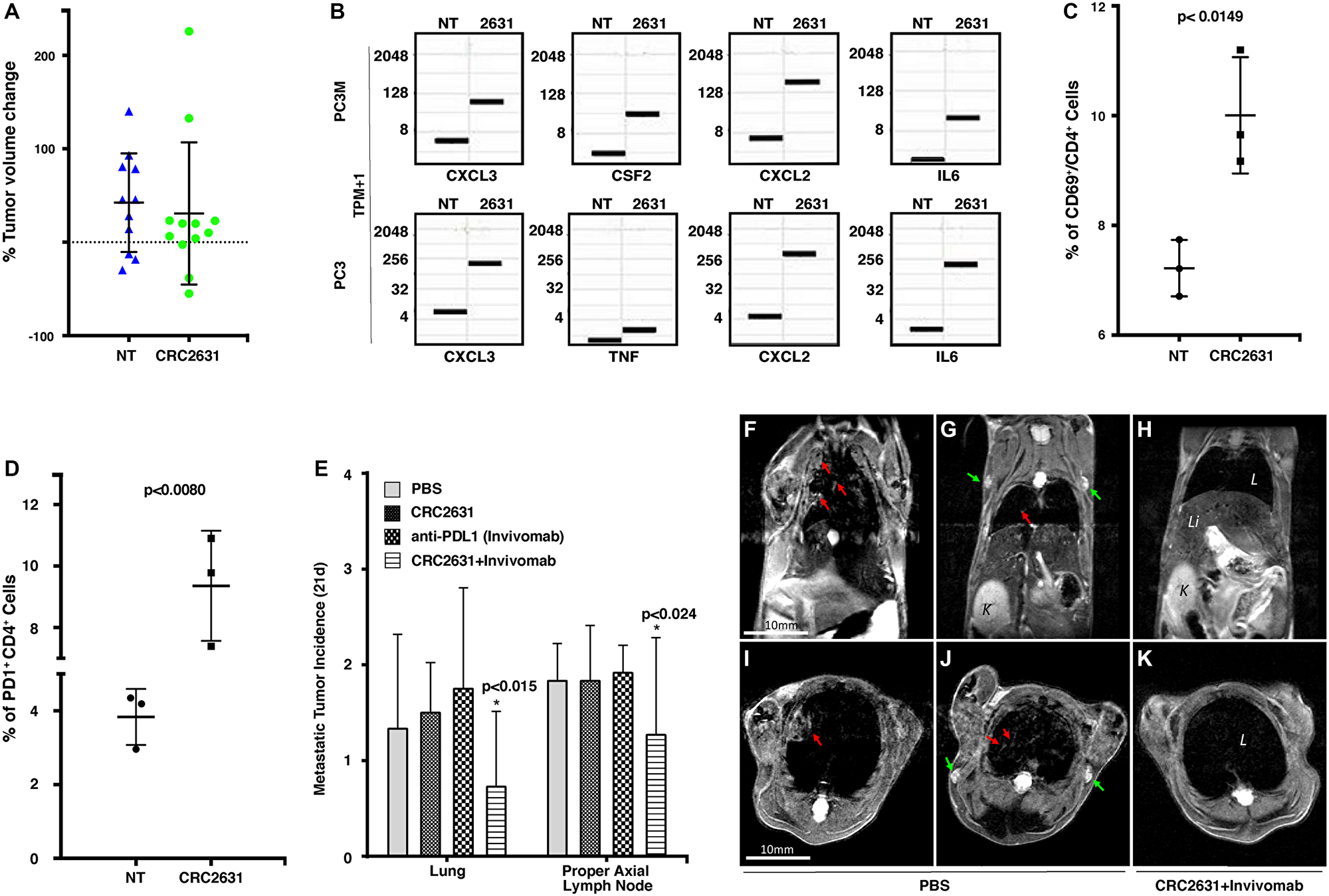 CRC2631/PD1 blockade combination treatment reduces metastatic burden