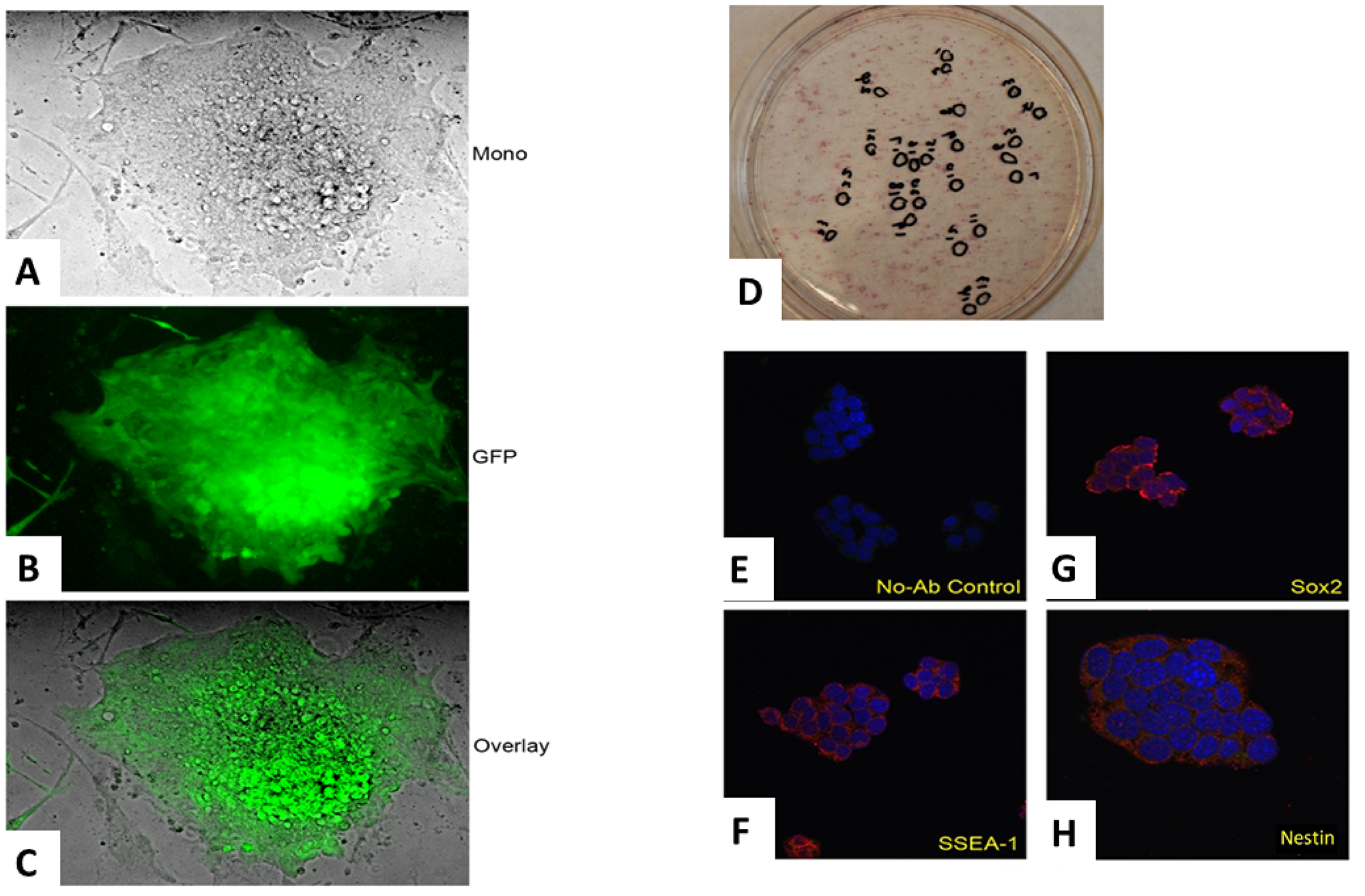 The production and confirmation of iPSC clones