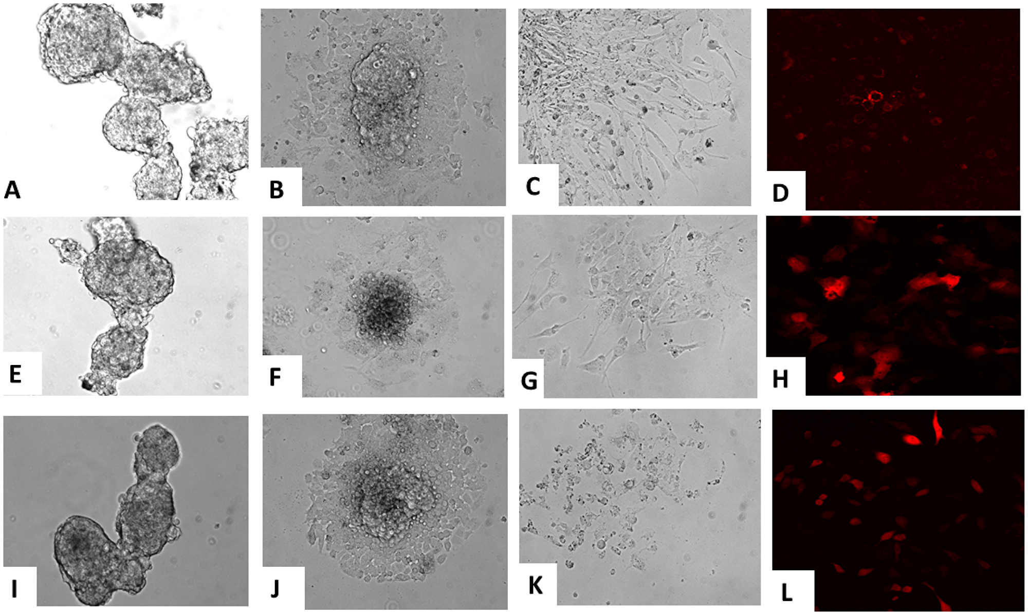 Pluripotent differentiation of iPSC clones in vitro