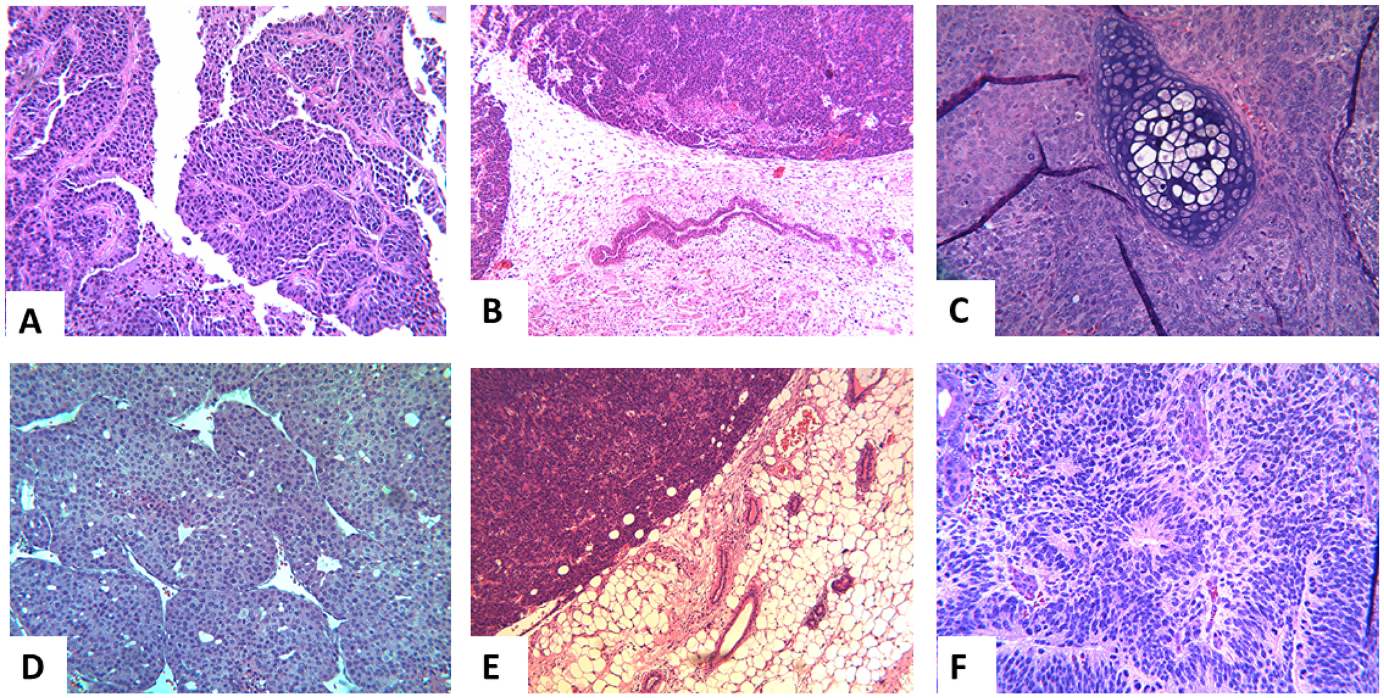 Representative histology of the extirpated tumors in the different groups