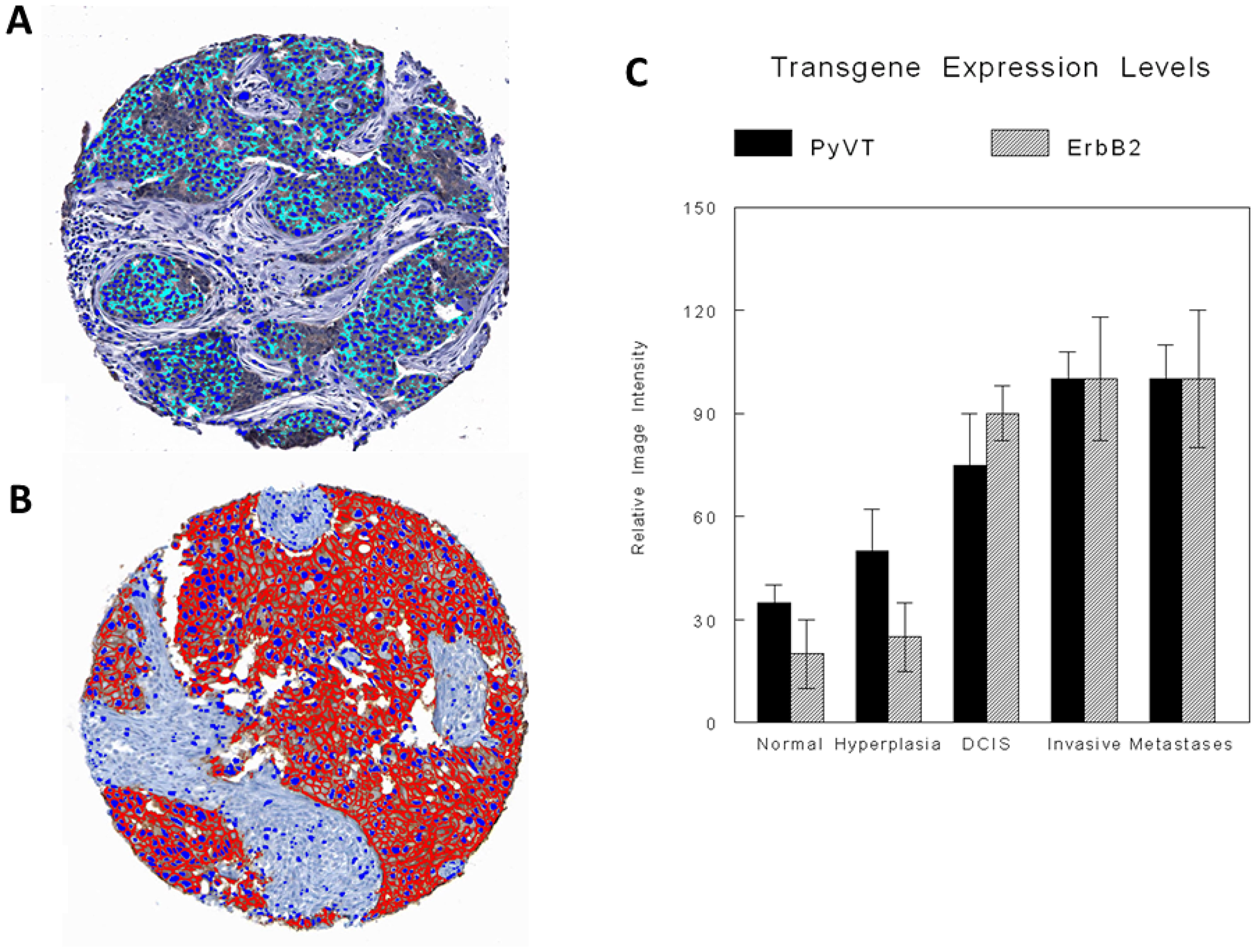Digital image analysis with specific recognition algorithms (SRAs)