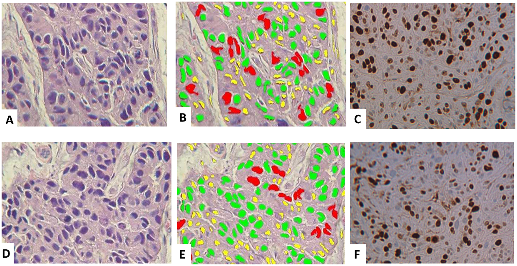 Histology and digital image analysis with additional specific recognition algorithms (SRAs)