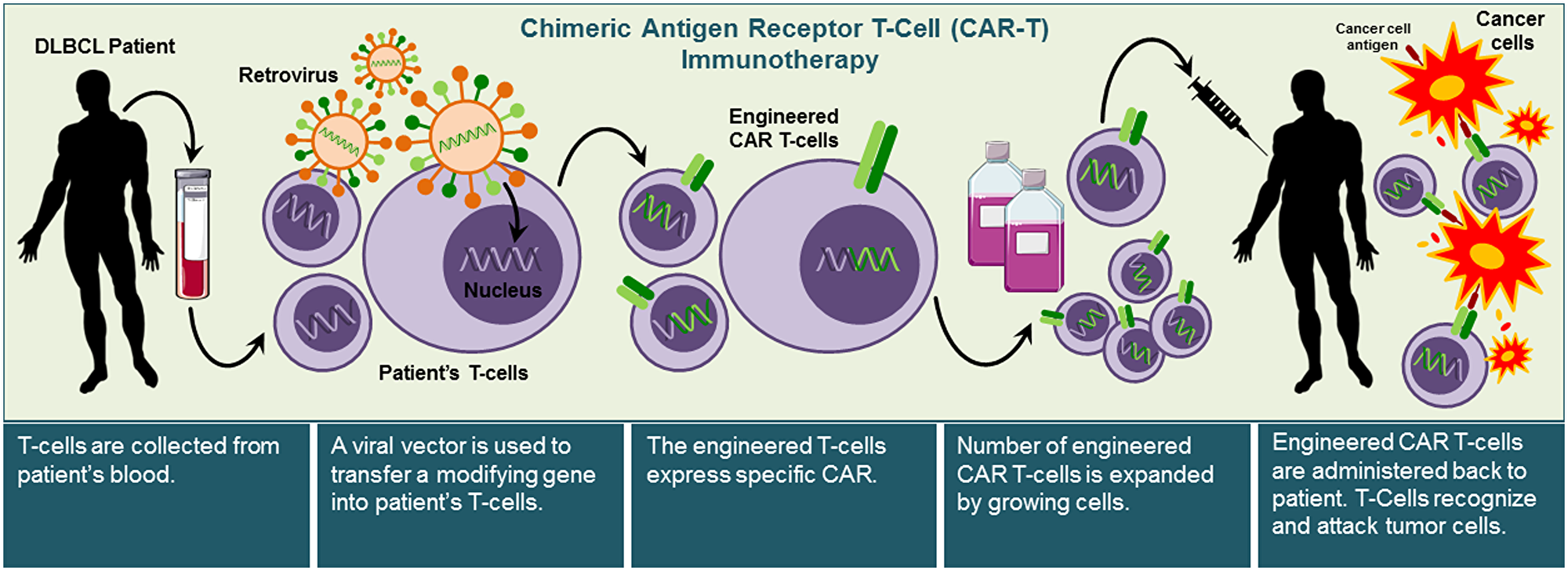 Illustration of chimeric antigen receptor T-cell (CAR-T) immunotherapy approach