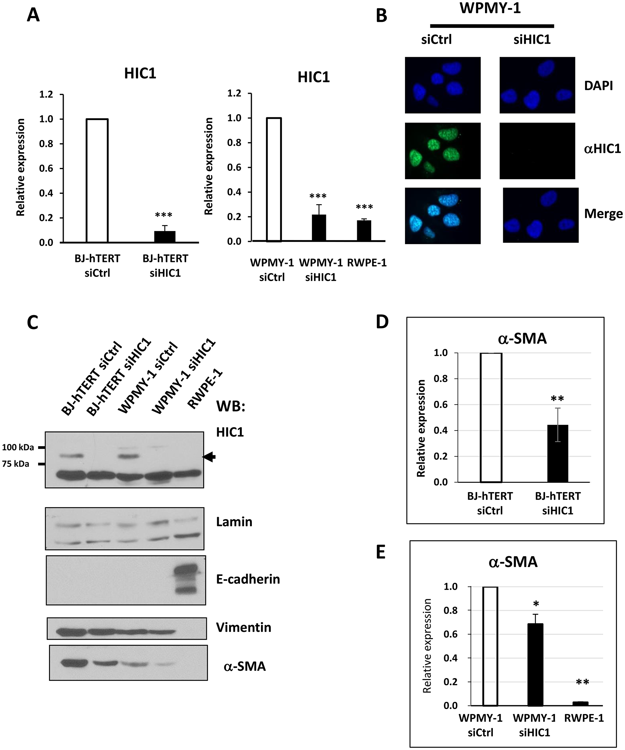 Analyses of HIC1 expression in the myofibroblastic cell line WPMY-1 compared to the epithelial cell line RWPE1