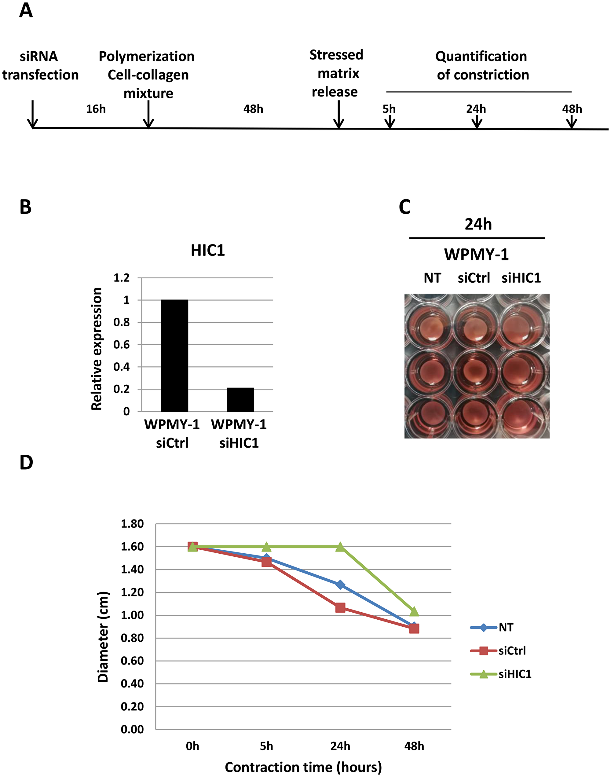 HIC1 inactivation impairs the contractility of the myofibroblastic cell line WPMY-1