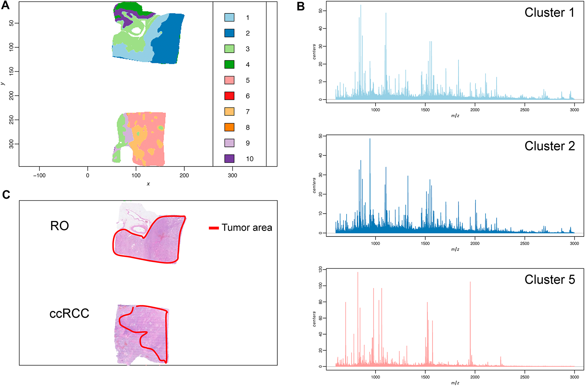 Tumor sample heterogeneity is revealed by mass spectrometry imaging and unsupervised clustering