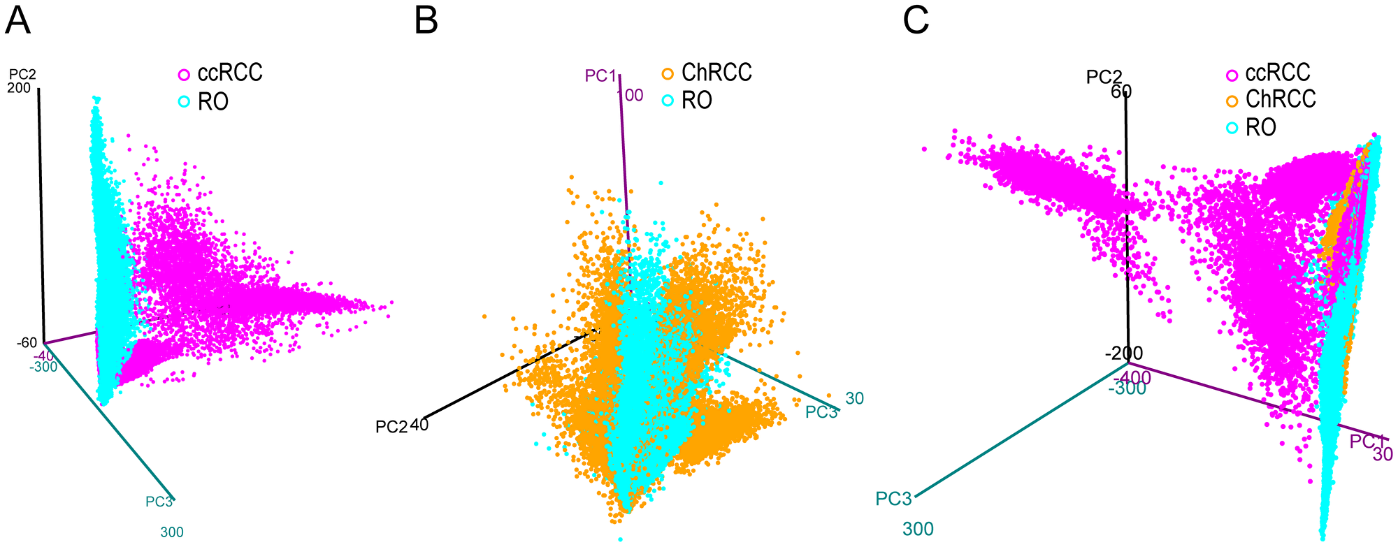 3D PCA score plot from imaging MALDI MS experiments of kidney tumor tissues