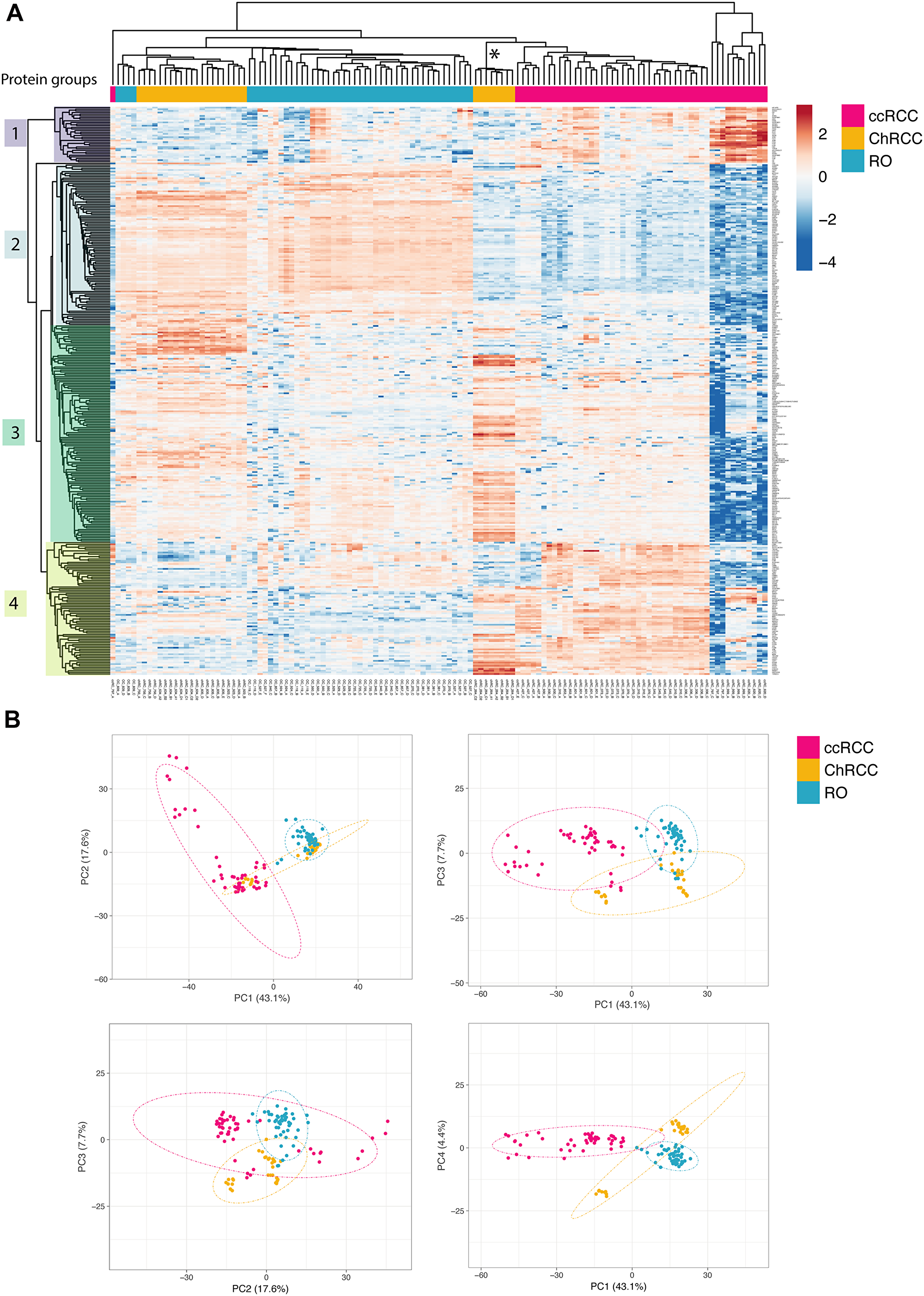Unsupervised renal cancer subtype classification by microproteomics using rapid LC-MS/MS protein profiling