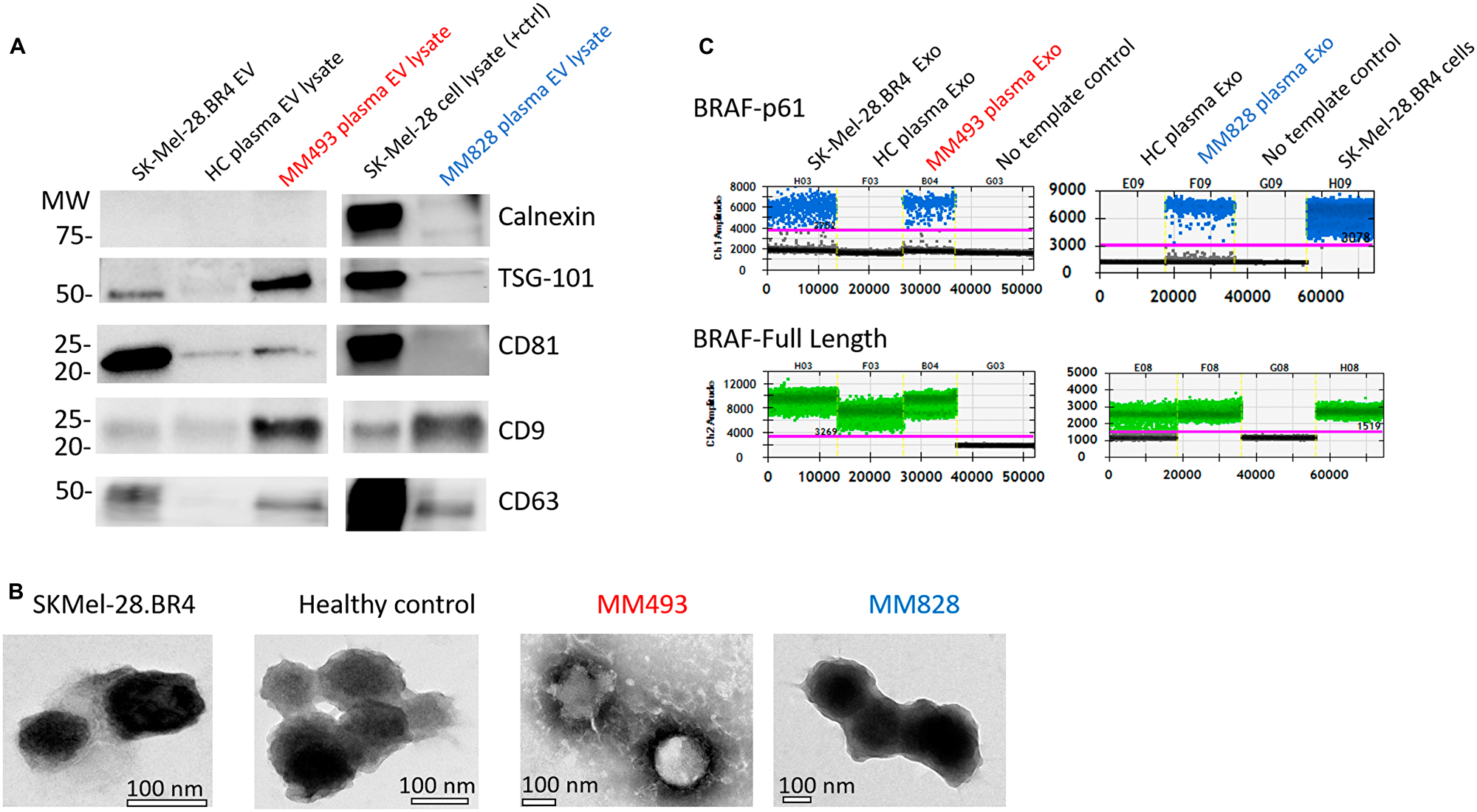 Validation of EV isolation from exo-easy and confirmation of splicing variant presence