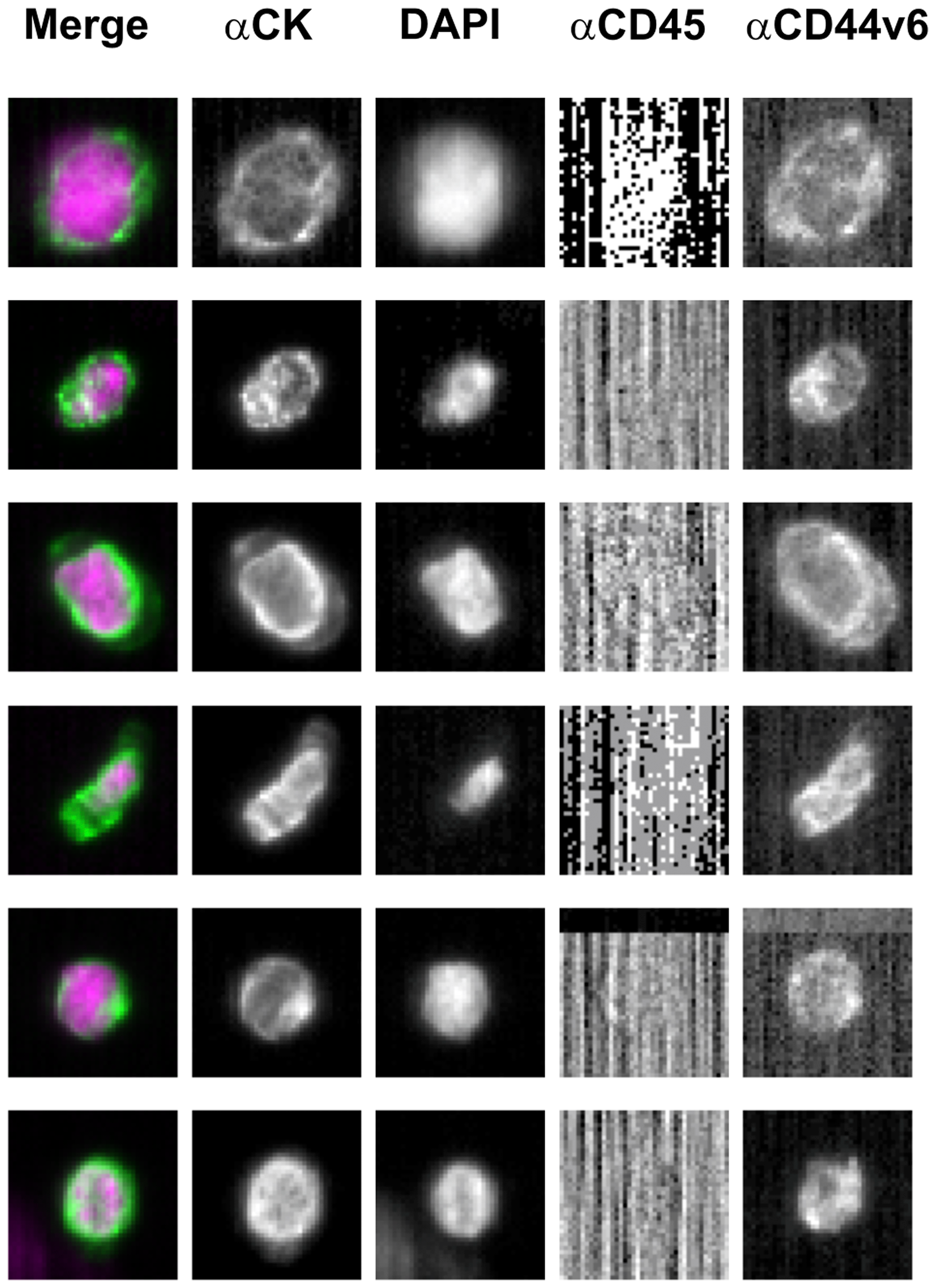 Representative images of CD44v6-positive circulating tumor cells isolated from one metastatic colorectal patient