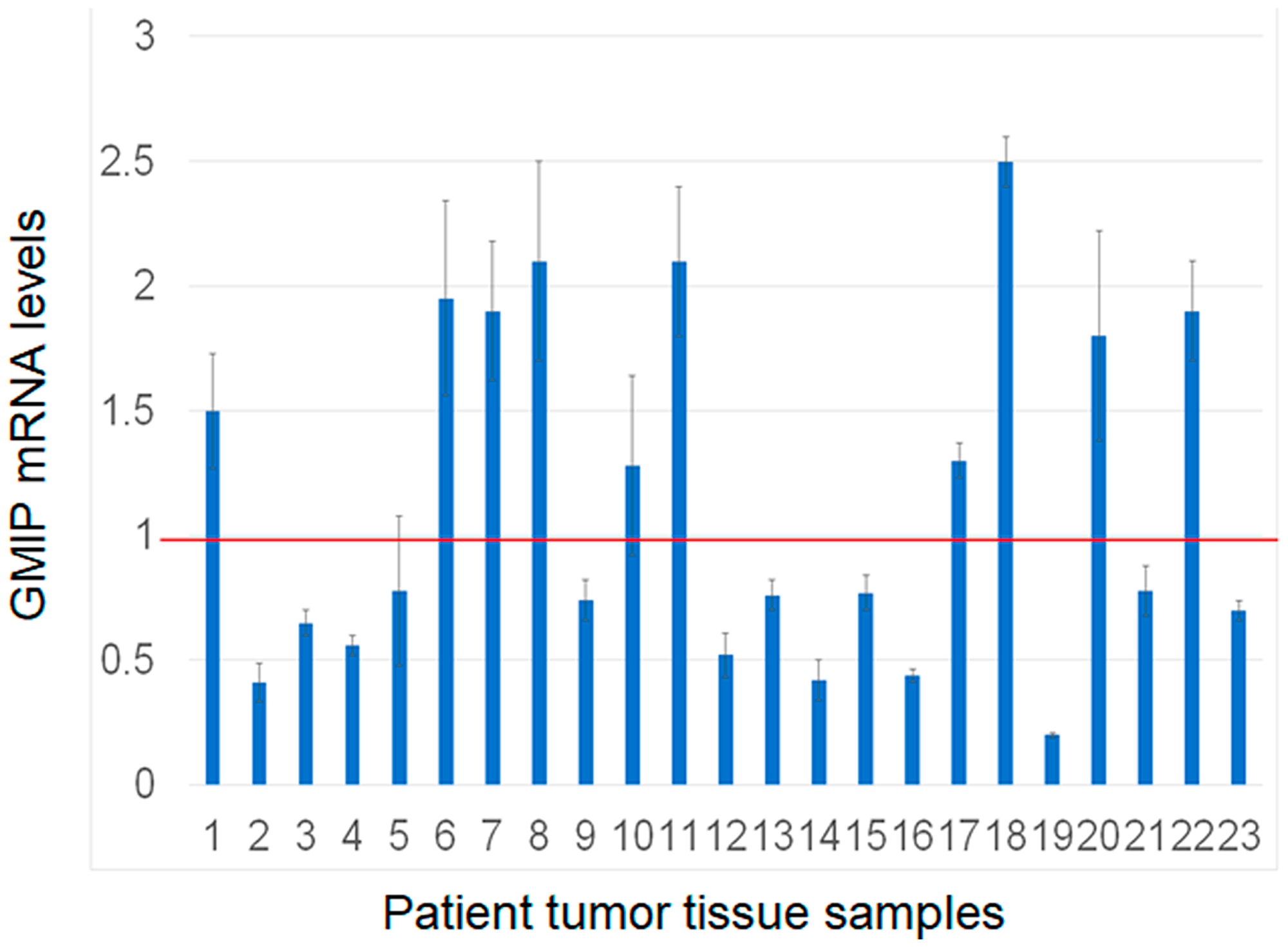 Assessment of GMIP gene expression by RT-PCR in human lung cancer and matched normal tissue samples (n = 23)