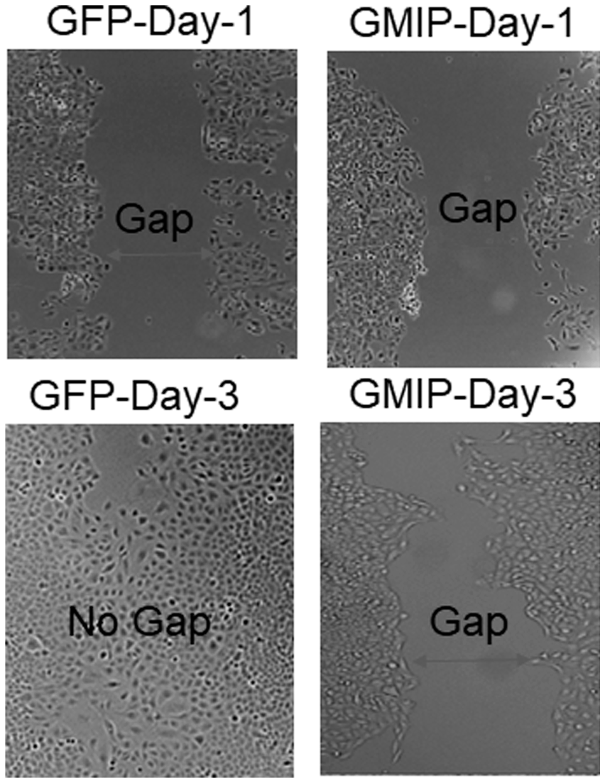 GMIP over-expression inhibits lung cancer cell migration