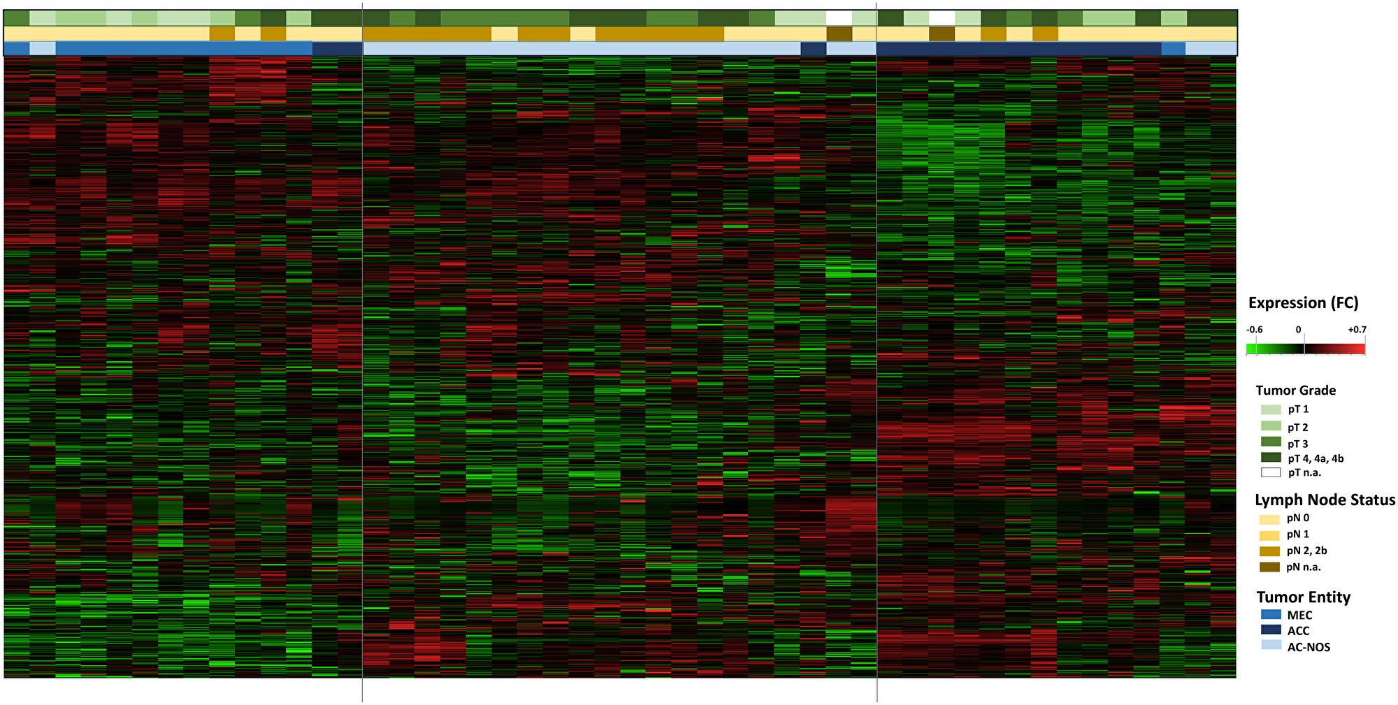 Hierarchical cluster Heatmap Analysis of tumor entities with tumor growth (pT) and lymphogenic metastasis (pN): All tumor samples of the 47 patients are shown (n = 47, x-axis)