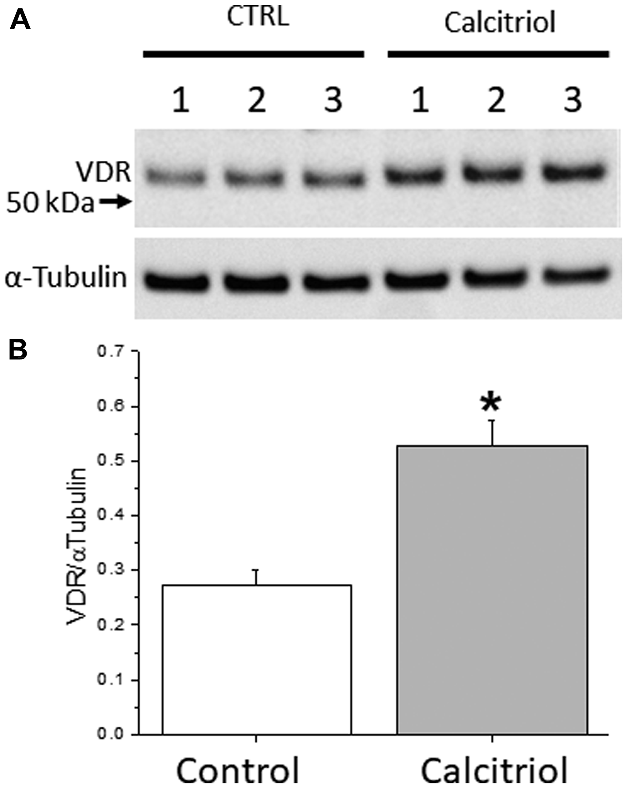 Vitamin D receptor (VDR) expression in cultured ovarian surface epithelial (OSE) cells