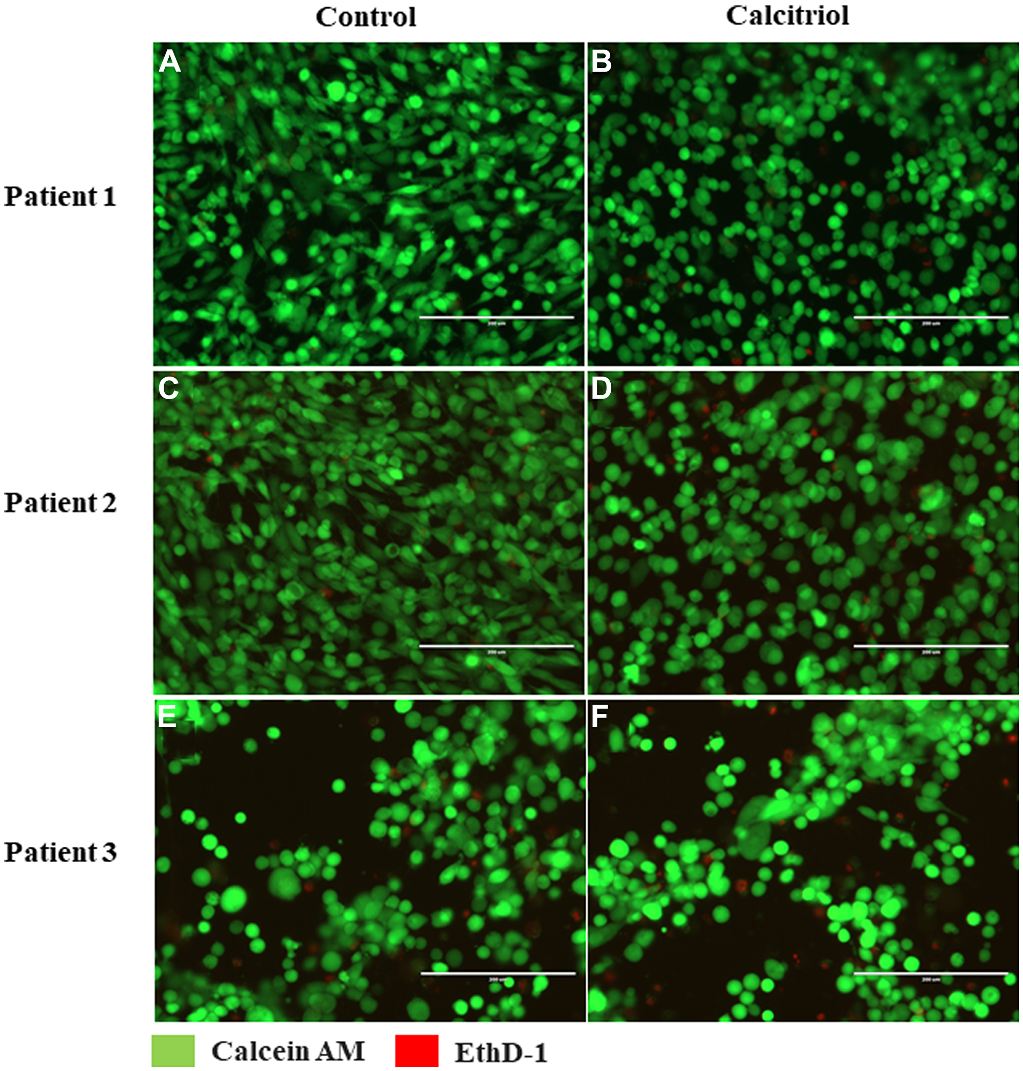 Vitamin D-regulated viability of cultured ovarian surface epithelial (OSE) cells