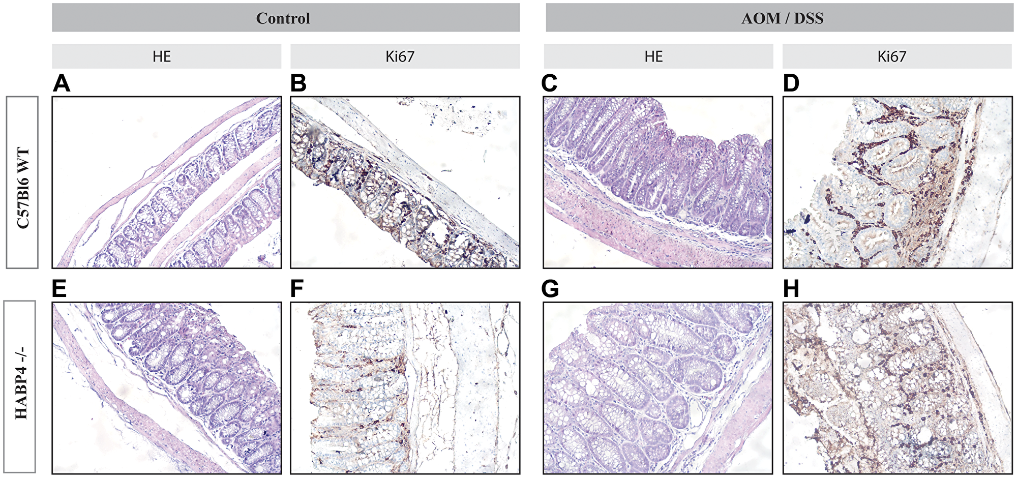 Histological sections of colon tissues of wild-type and Habp4 –/– mice