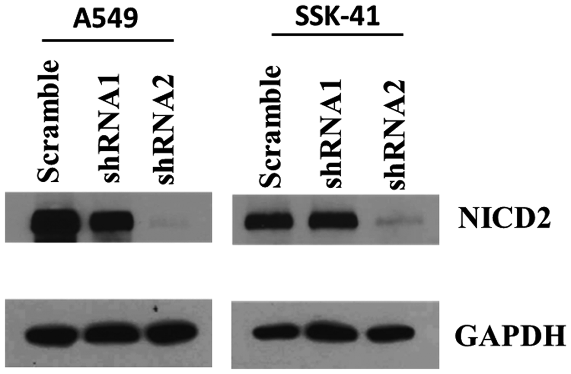 Efficiency of Notch2 knockdown in A549 and SSK-41 cells by lentiviral vectors bearing shRNA