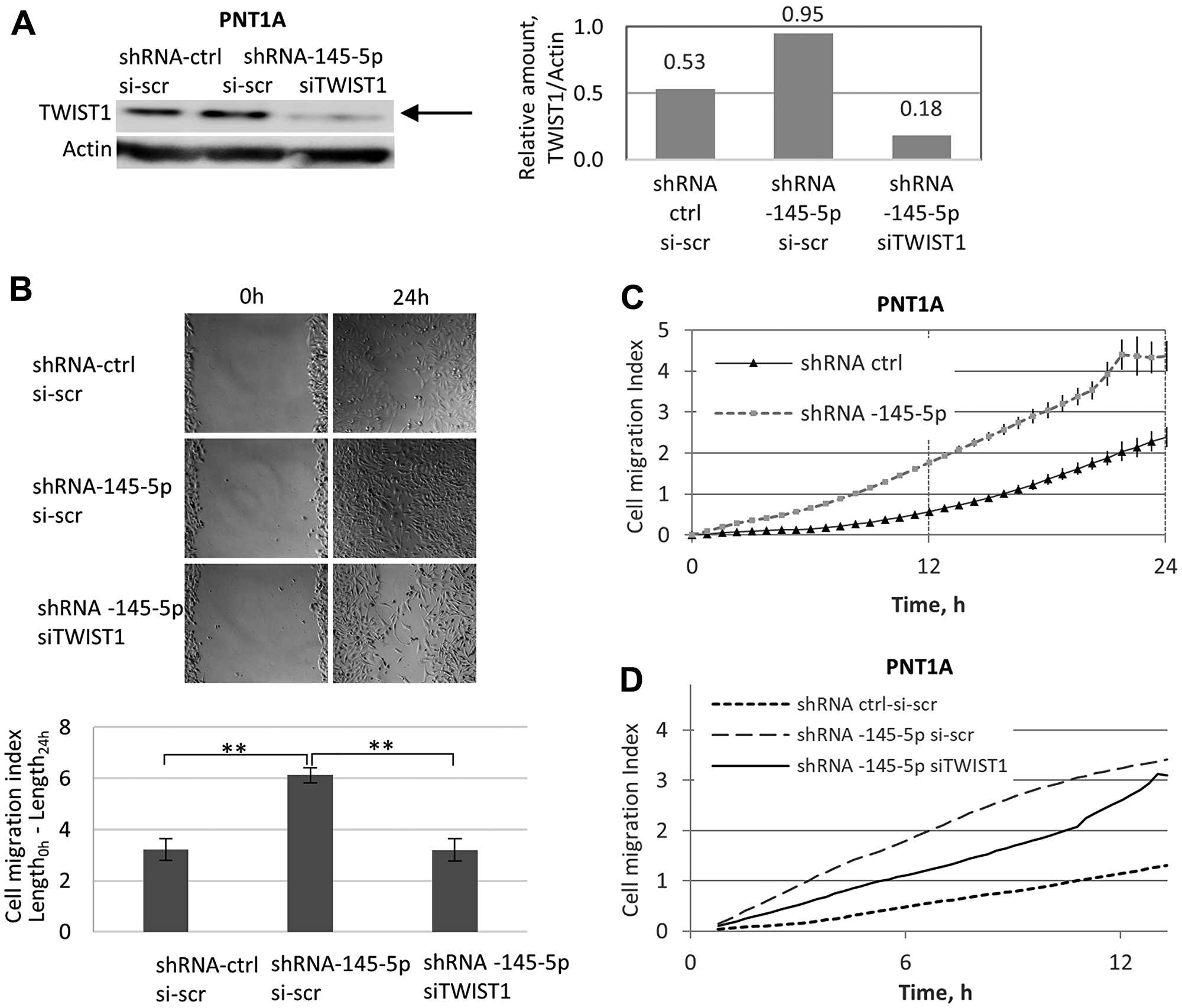 Opposing roles of shRNA-145-5p and TWIST1 siRNA on PNT1A cell migration