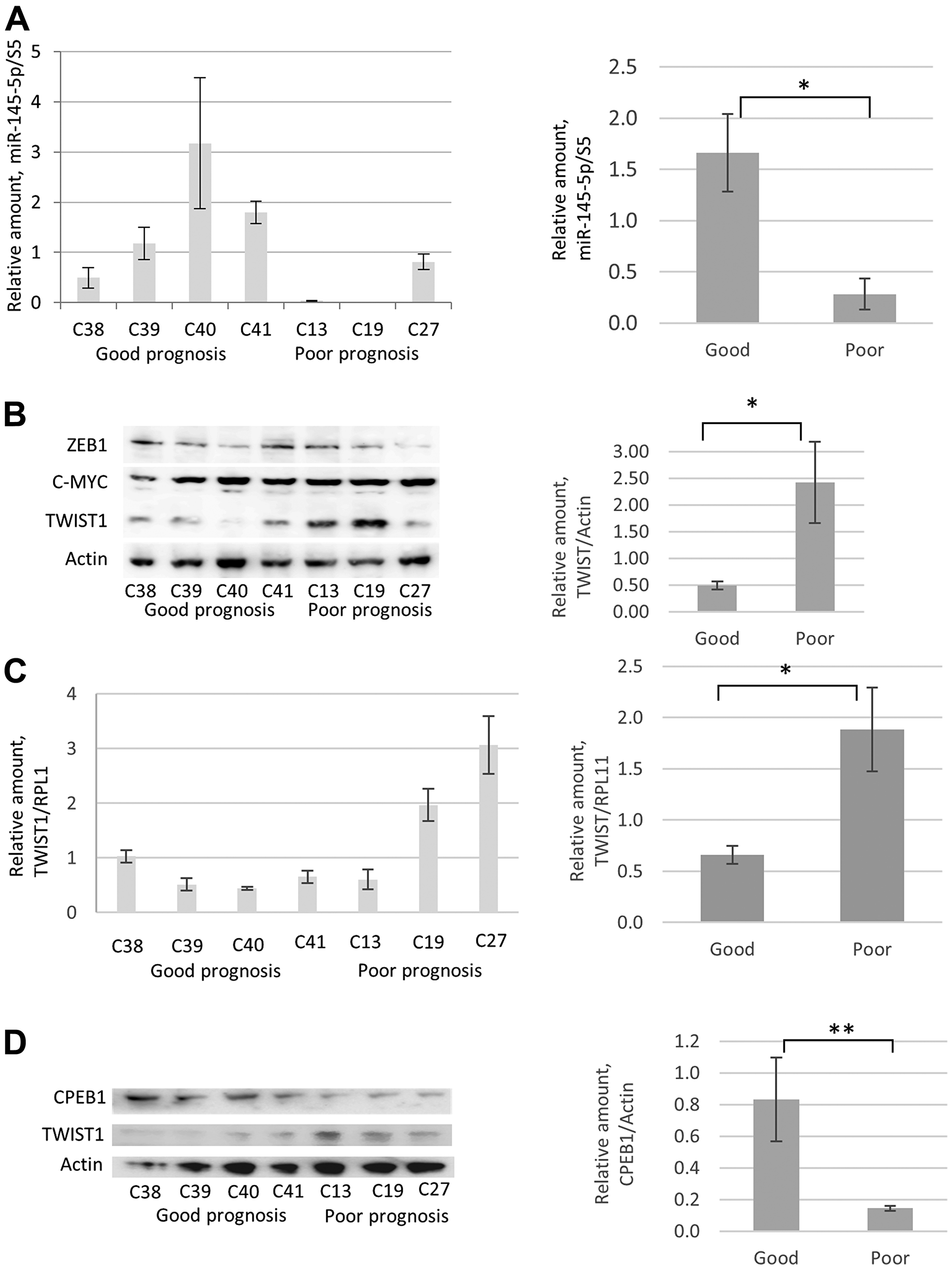 Comparative analyses of miR-145-5p, TWIST1, and CPEB1 expression in prostate cancer cell lines derived from PCa tumor samples from patients with good and poor prognoses