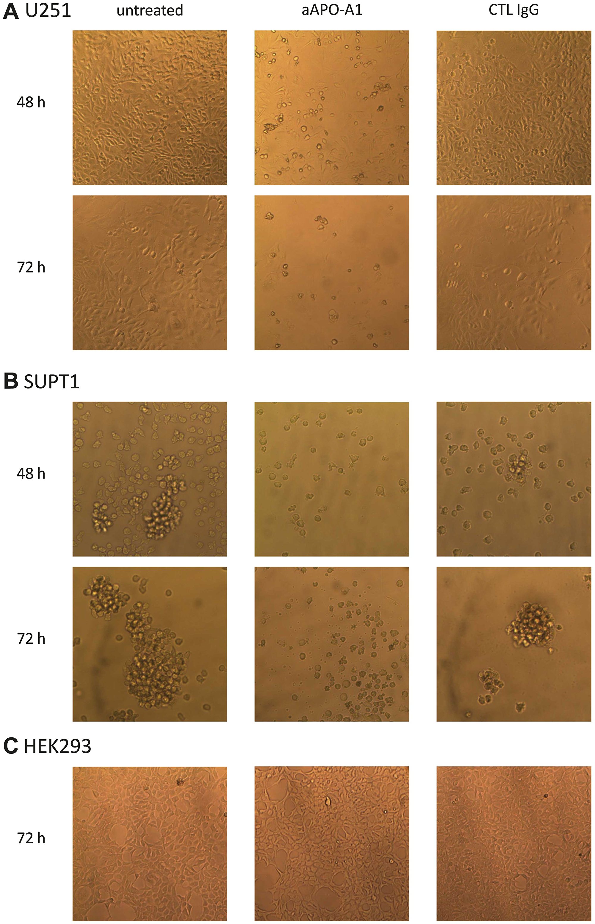Morphology change of cells cultured in presence of anti-apoA-1 IgG or control isotype IgG
