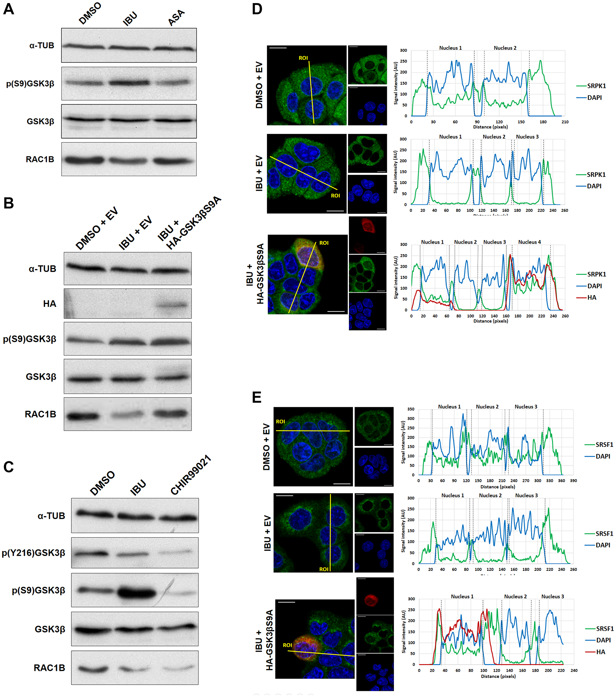 Ibuprofen requires GSK3β inhibition for decreasing RAC1B levels