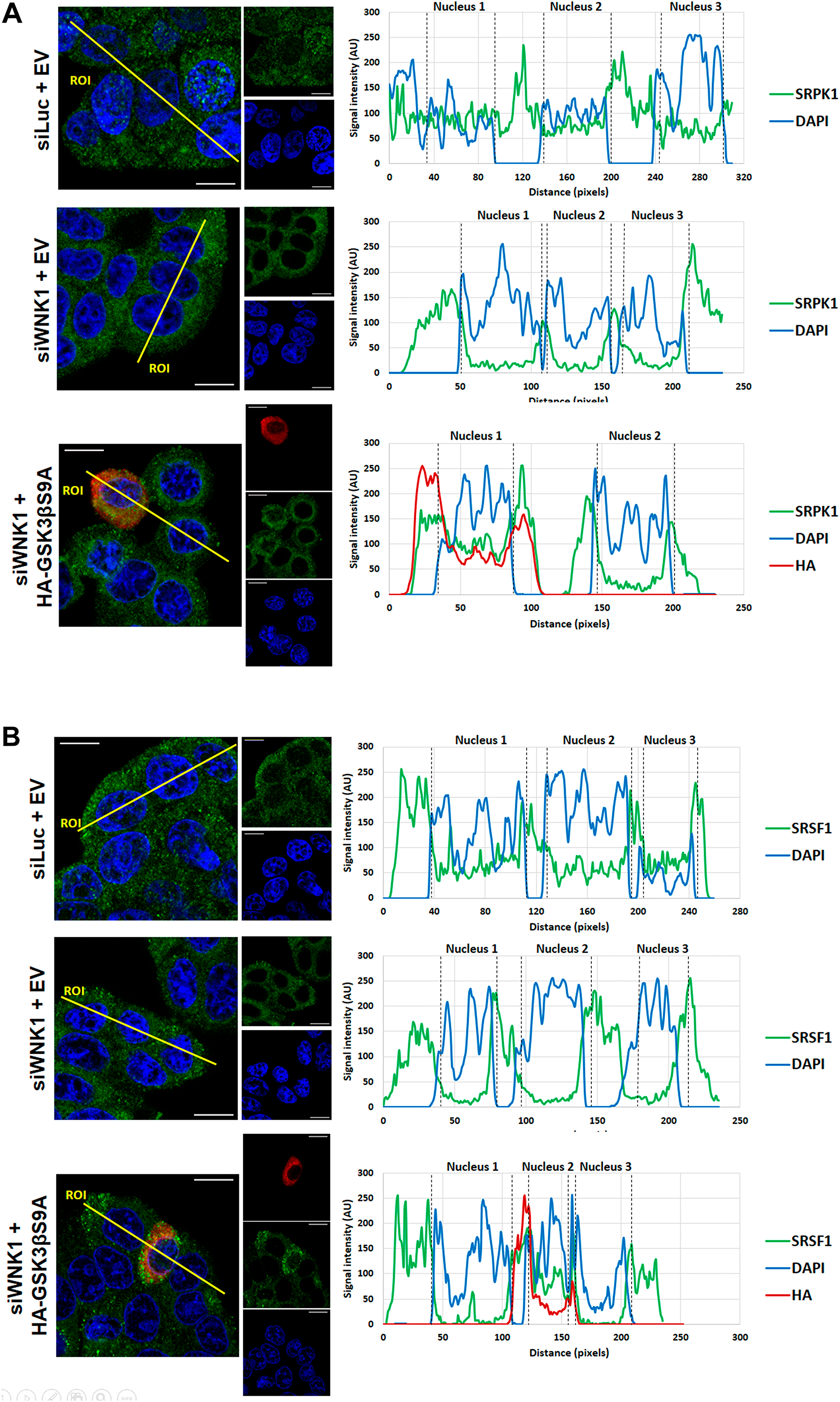 Effect of WNK1 depletion on SRPK1 and SRSF1 subcellular localization