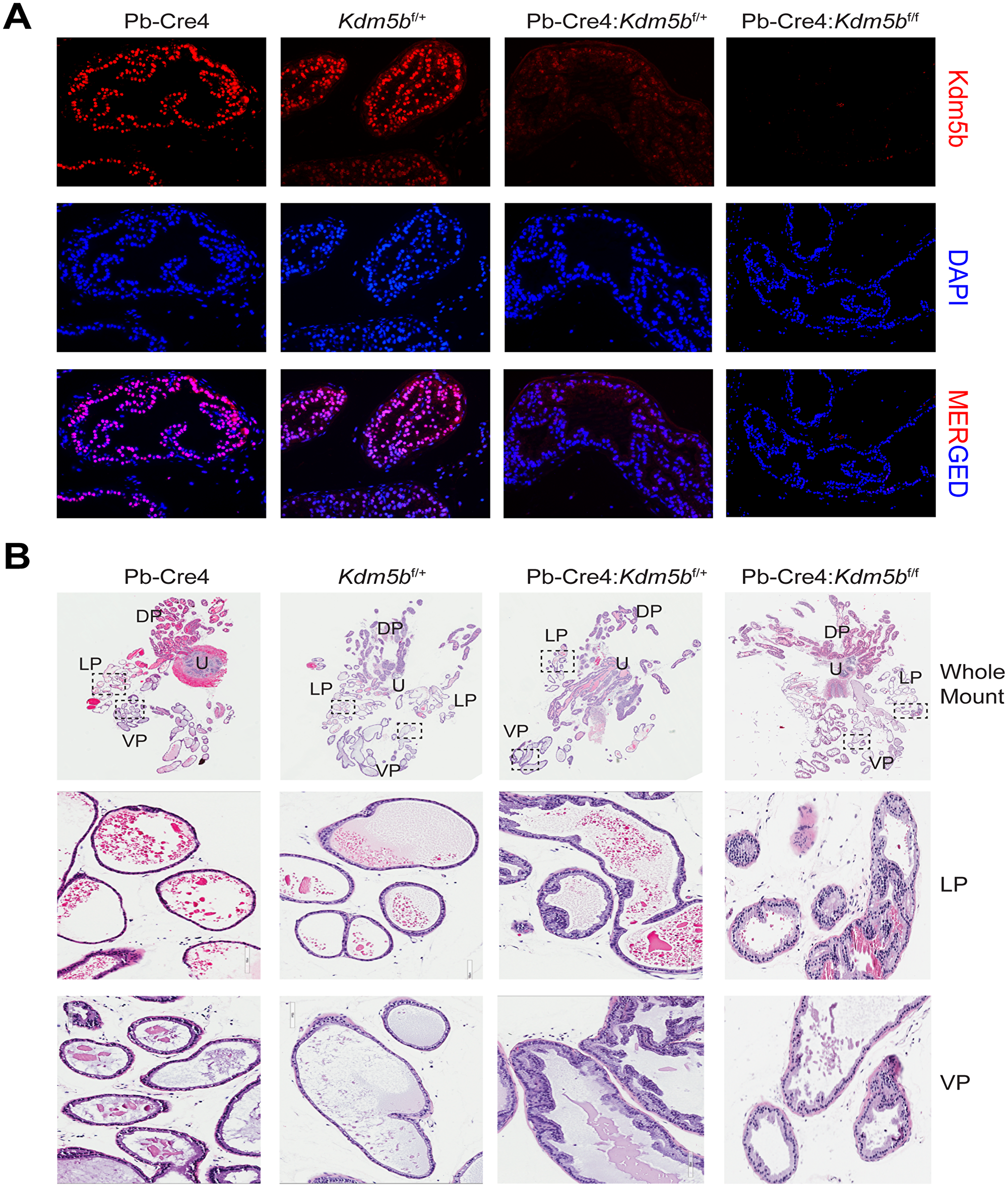 Kdm5b deficient mouse prostates manifest low-grade hyperplasia