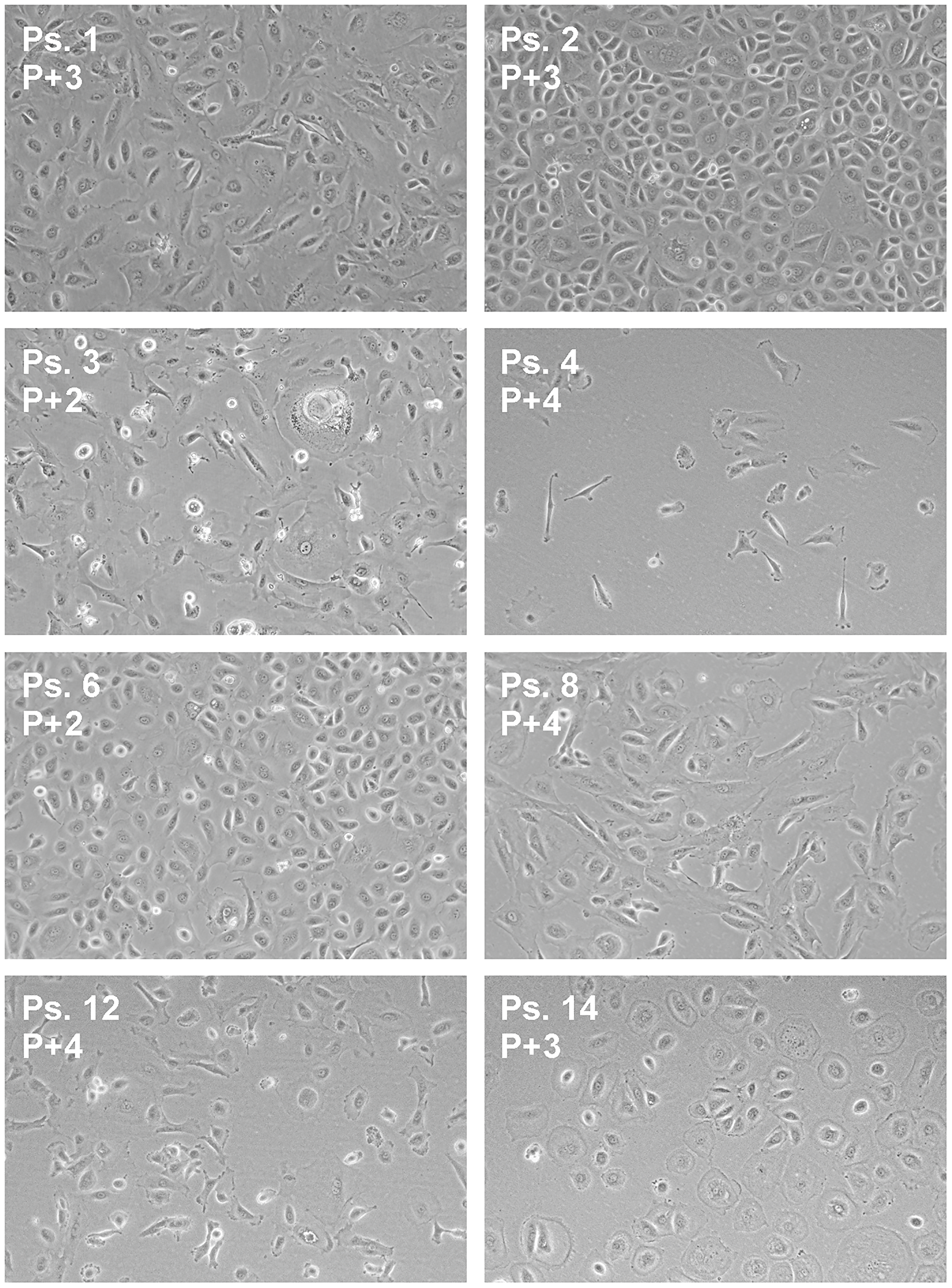 Morphology of ascites-derived adherent cells