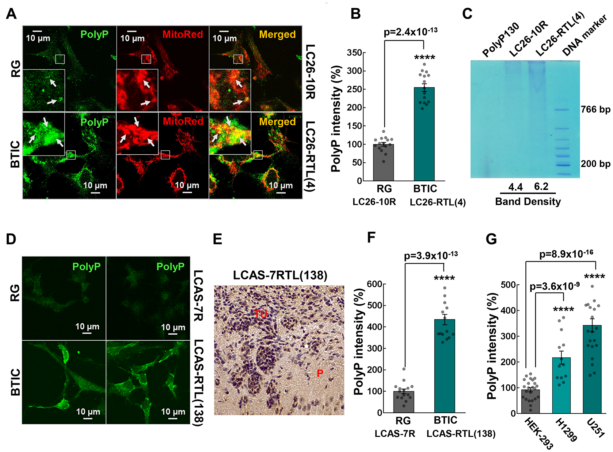 (A) Colocalization of polyP with mitochondria of LC26-10R (RG) and LC26-RTL(4) (BTIC) cells. PolyP was detected by immunocytochemistry using polyP-binding domain (PPBD) affinity labeling (green). Mitochondria were stained with MitoTracker Red CMXRos. (B) Intensities of polyP signal in LC26-10R vs. LC26-RTL(4). (C) polyP extraction from LC26-10R (RG) and LC26- RTL(4) (BTIC) cells along with quantification of band density signal. (D) Representative fluorescent images of polyP labeling of LCAS-7R (RG) and LCAS-7RTL(138) (BTIC) cells. (E) DAB staining of polyP in LCAS-7RTL(138) generated tumor (2 month post-inoculation into NOD-SCID mice brain). P parenchyma; TU tumor mass. (F) Intensities of polyP signal in LCAS-7R (RG) vs. LCAS-7RTL(138) (BTIC). (G) Intensities of polyP signal in HEK-293 vs. H1299 lung cancer and U251 glioma cells.