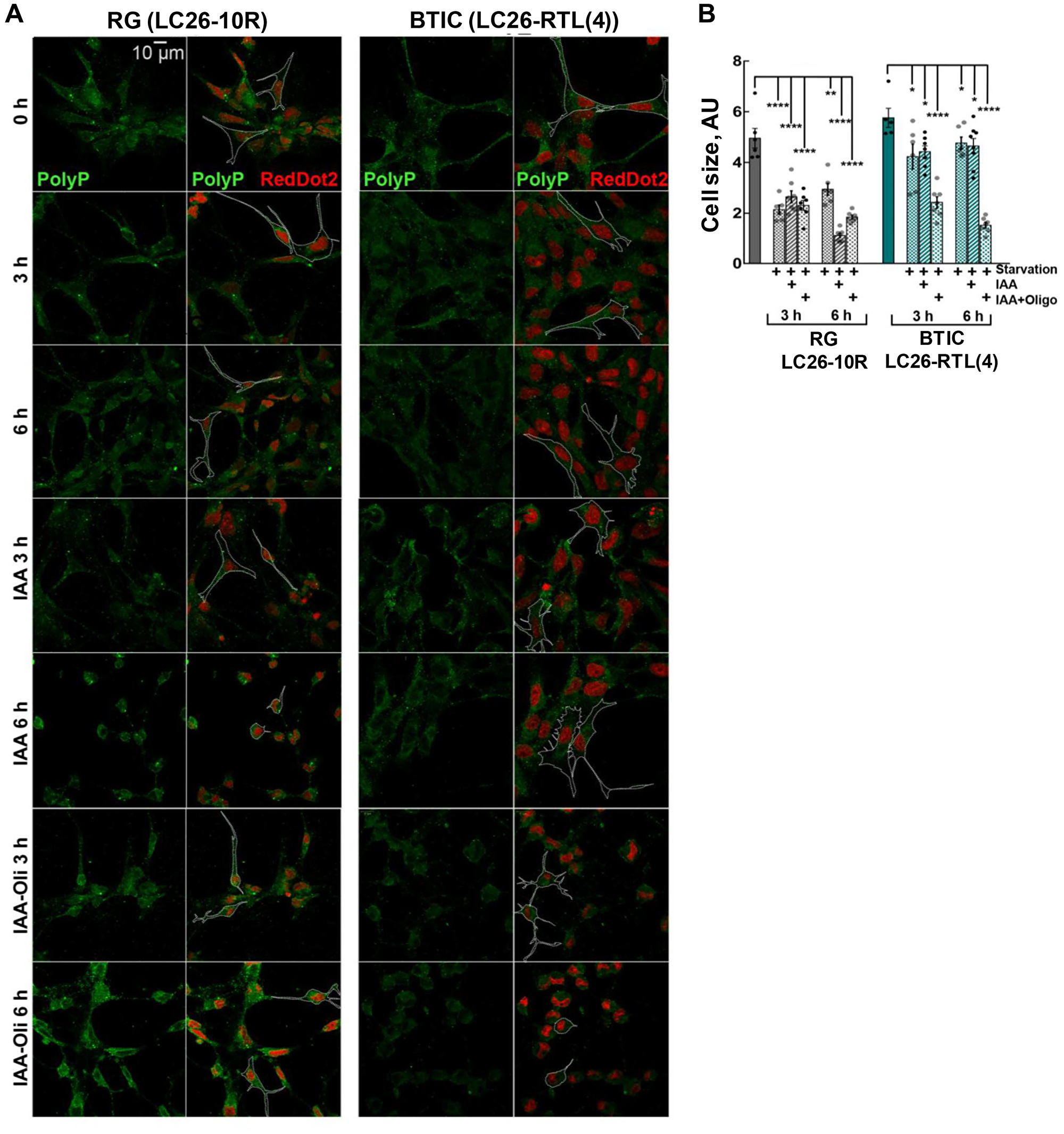 (A and B) Morphology and cellular size of LC26-10R (RG) and LC26- RTL(4) (BTICs) after 3 h and 6 h starvation, IAA, or IAA/Oligomycin treatment. PolyP staining (green). RedDot2 (red) nuclear staining.