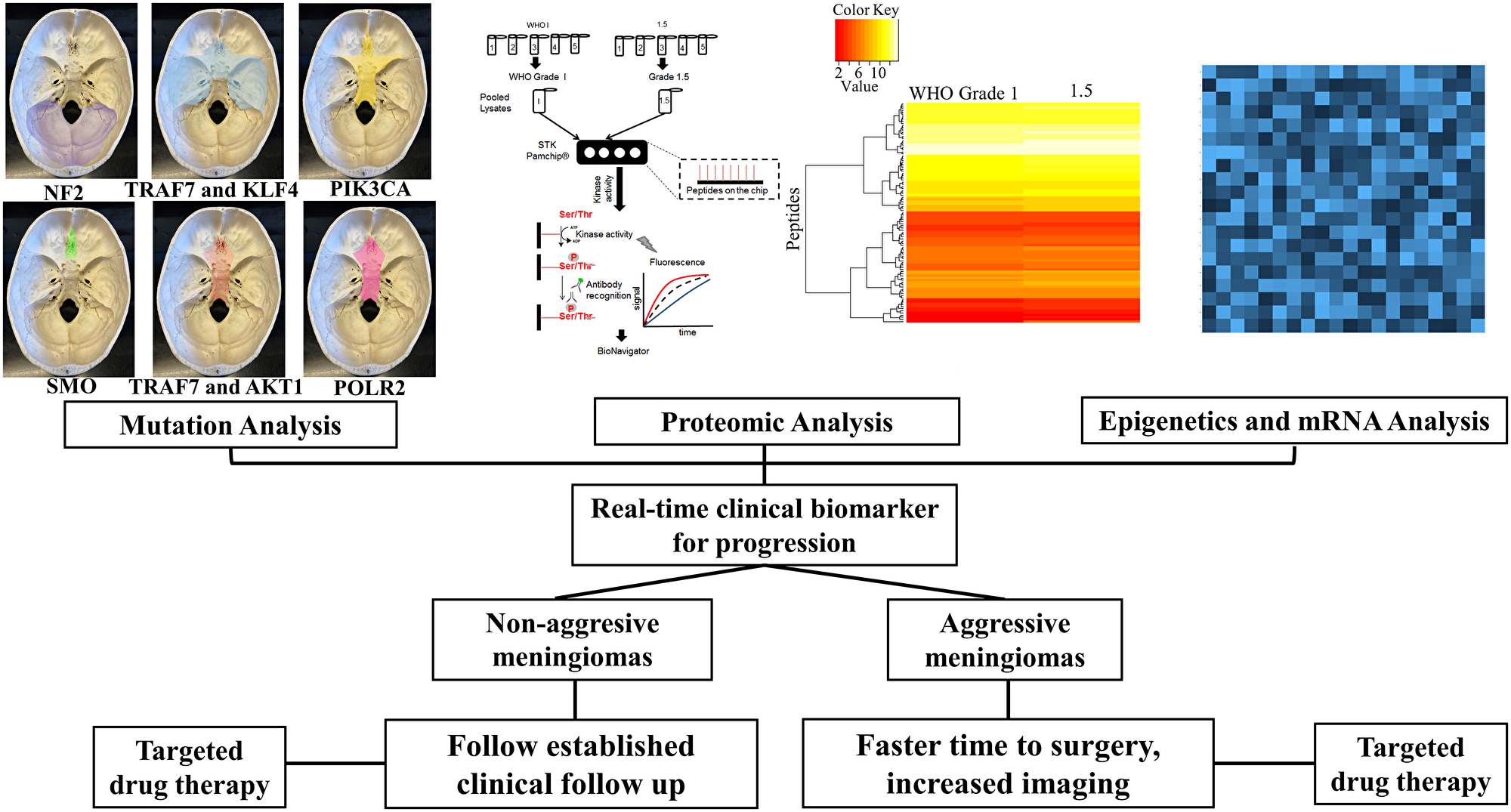 Multi-pronged approach for meningioma therapy