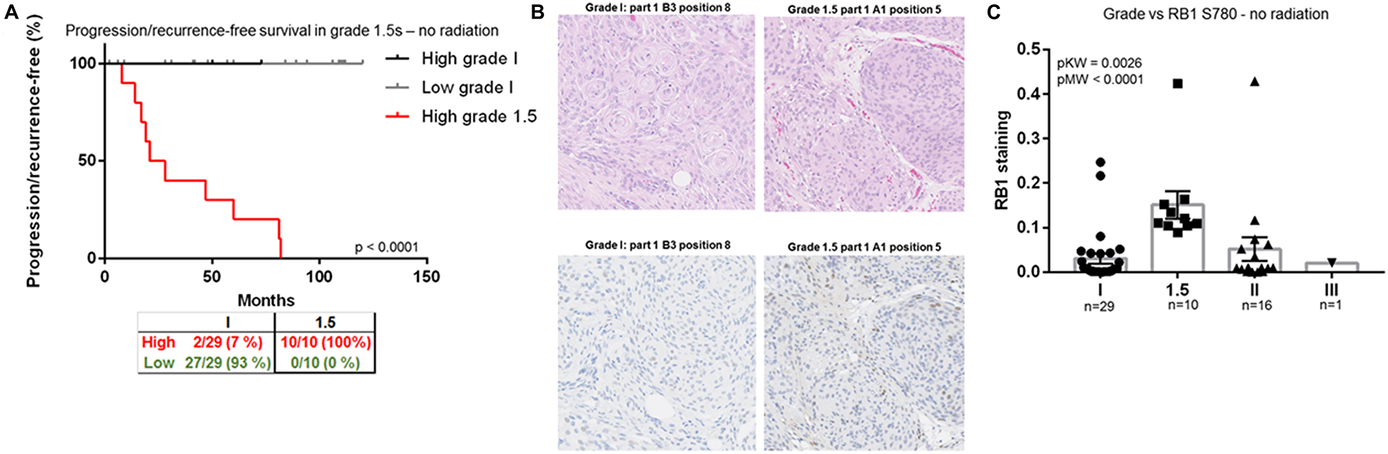 RB1, a biomarker for identification of grade 1.5 meningiomas
