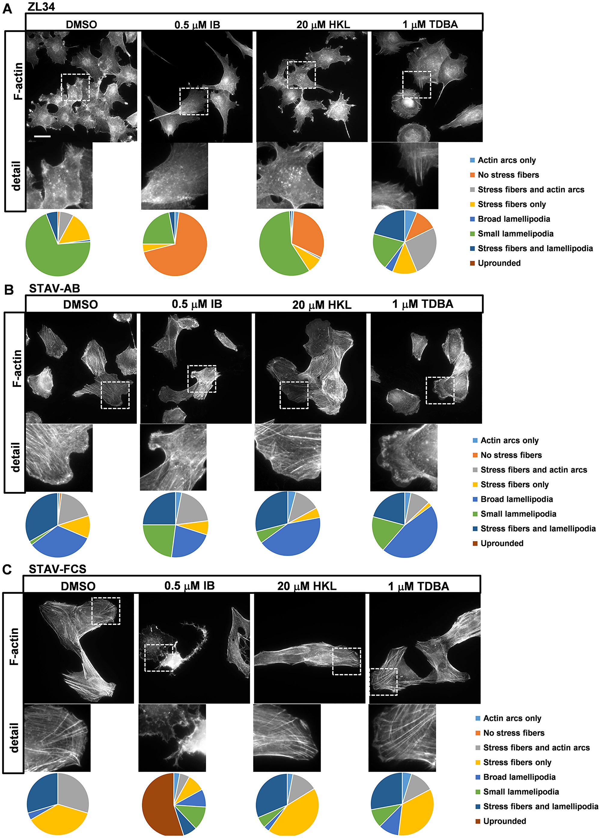 Effects of the inhibitors on organization of actin filaments